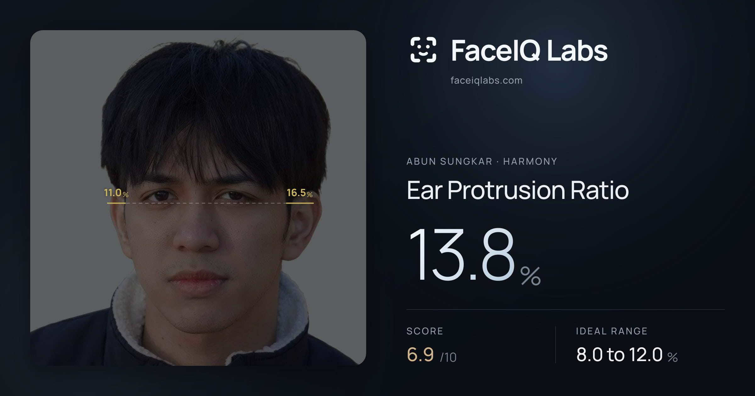 Abun Sungkar Ear Protrusion Ratio: 13.8%, drawn on the photo