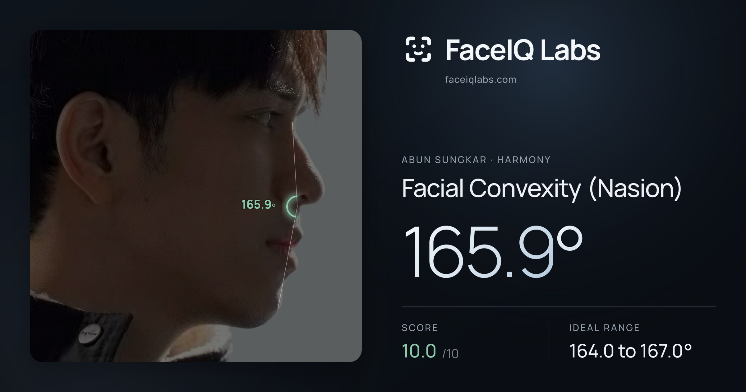 Abun Sungkar Facial Convexity (Nasion): 165.9°, drawn on the photo