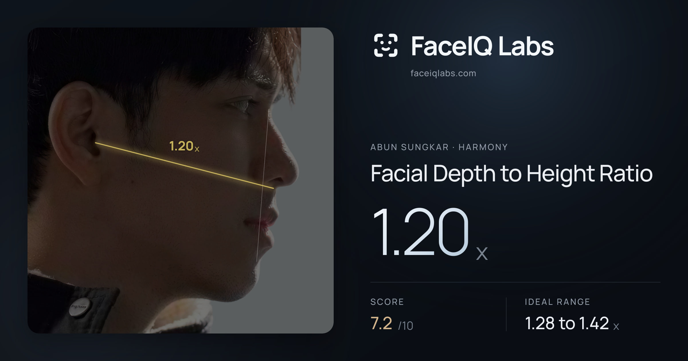 Abun Sungkar Facial Depth to Height Ratio: 1.20x, drawn on the photo