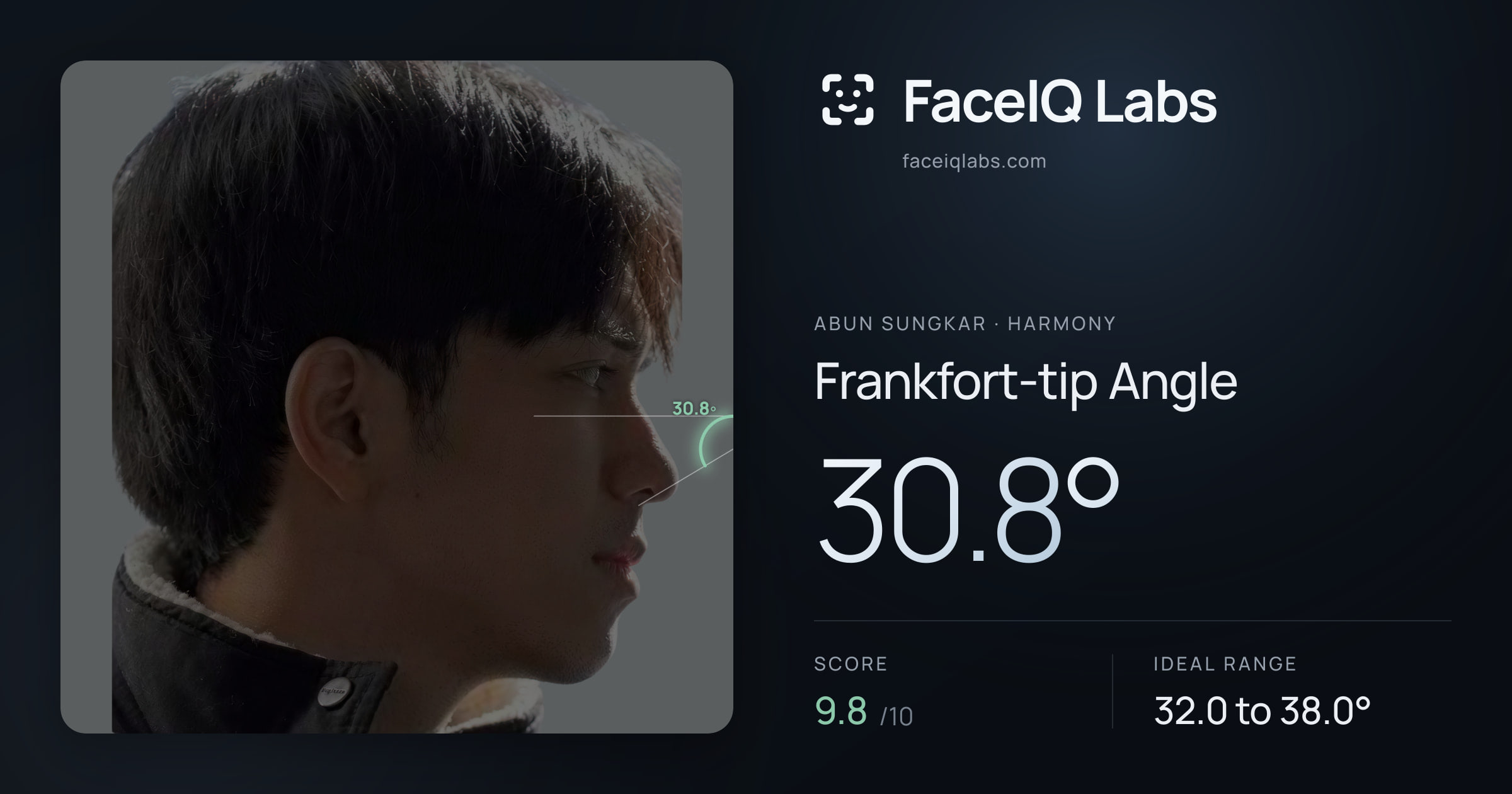 Abun Sungkar Frankfort-tip Angle: 30.8°, drawn on the photo