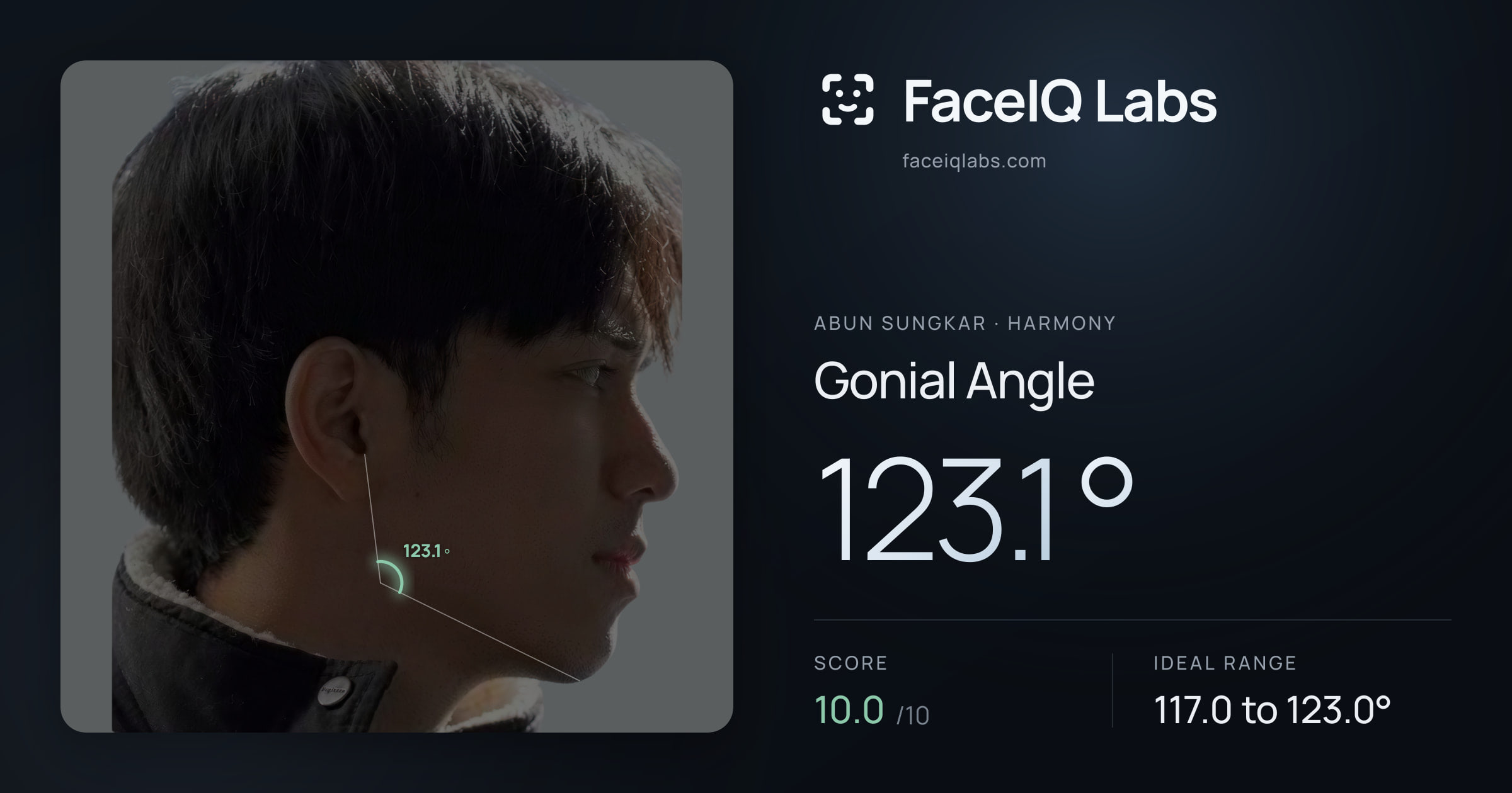 Abun Sungkar Gonial Angle: 123.1°, drawn on the photo