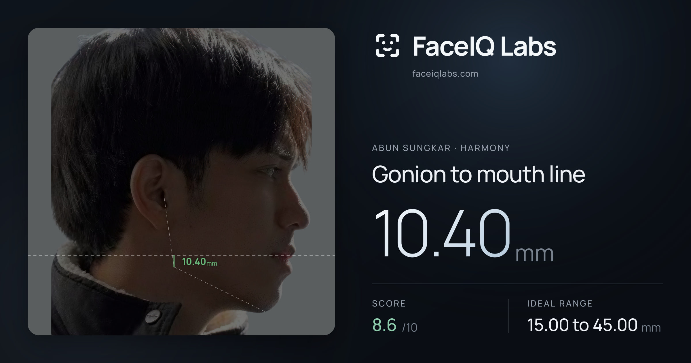 Abun Sungkar Gonion to mouth line: 10.40mm, drawn on the photo