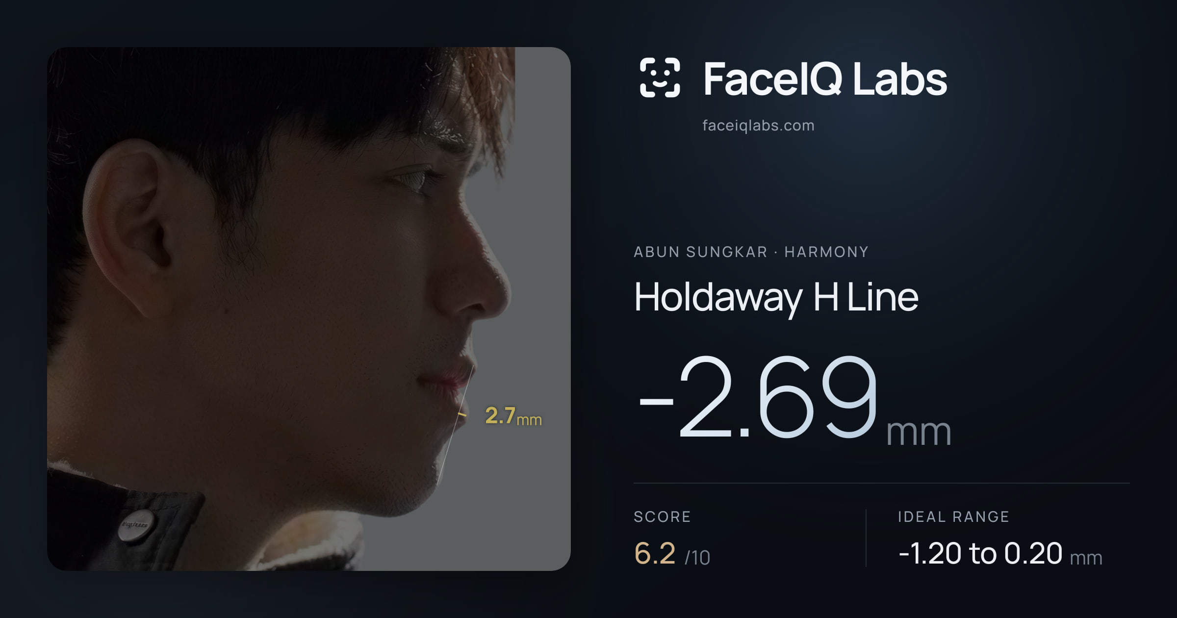 Abun Sungkar Holdaway H Line: -2.69mm, drawn on the photo