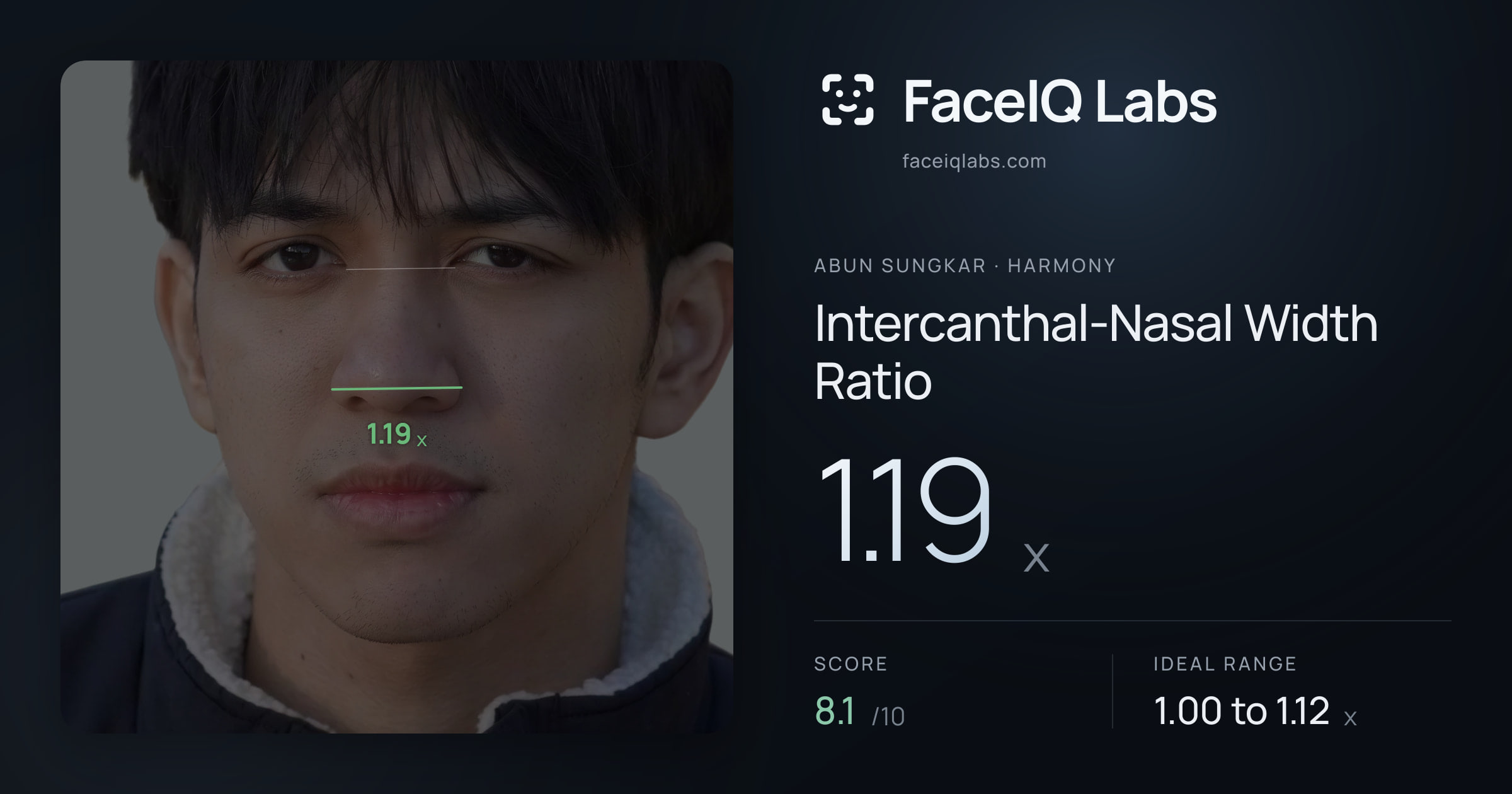 Abun Sungkar Intercanthal-Nasal Width Ratio: 1.19x, drawn on the photo