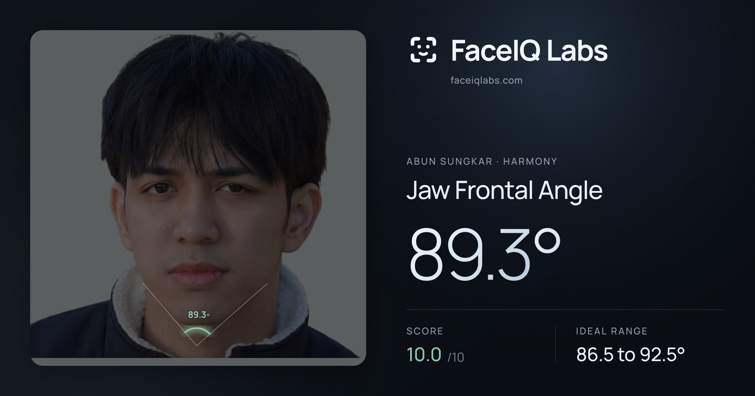 Abun Sungkar Jaw Frontal Angle: 89.3°, drawn on the photo