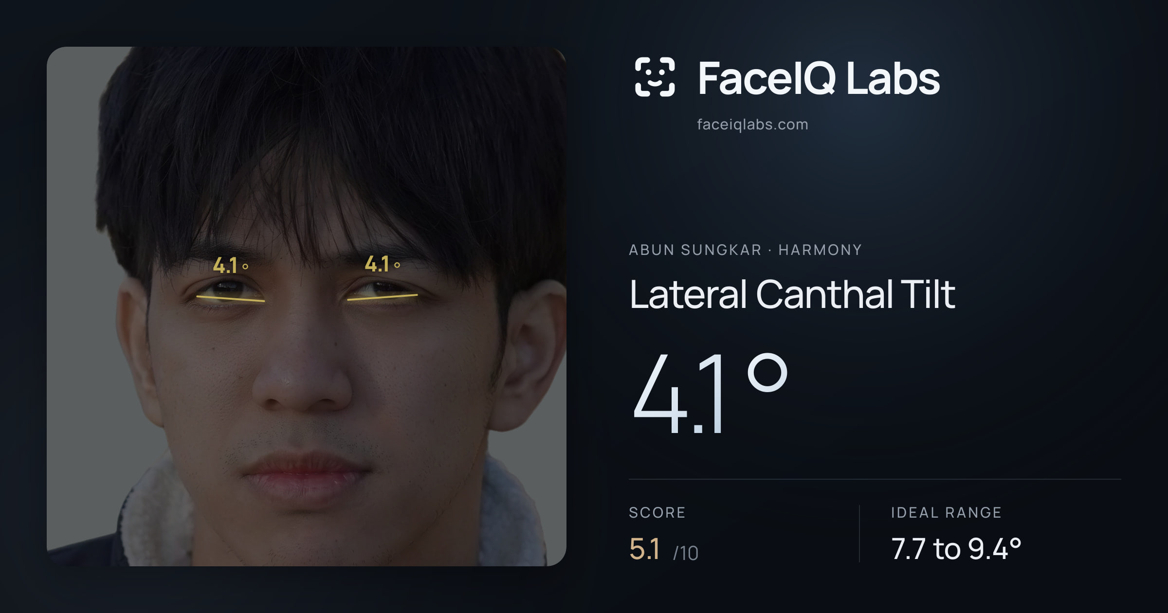Abun Sungkar Lateral Canthal Tilt: 4.1°, drawn on the photo