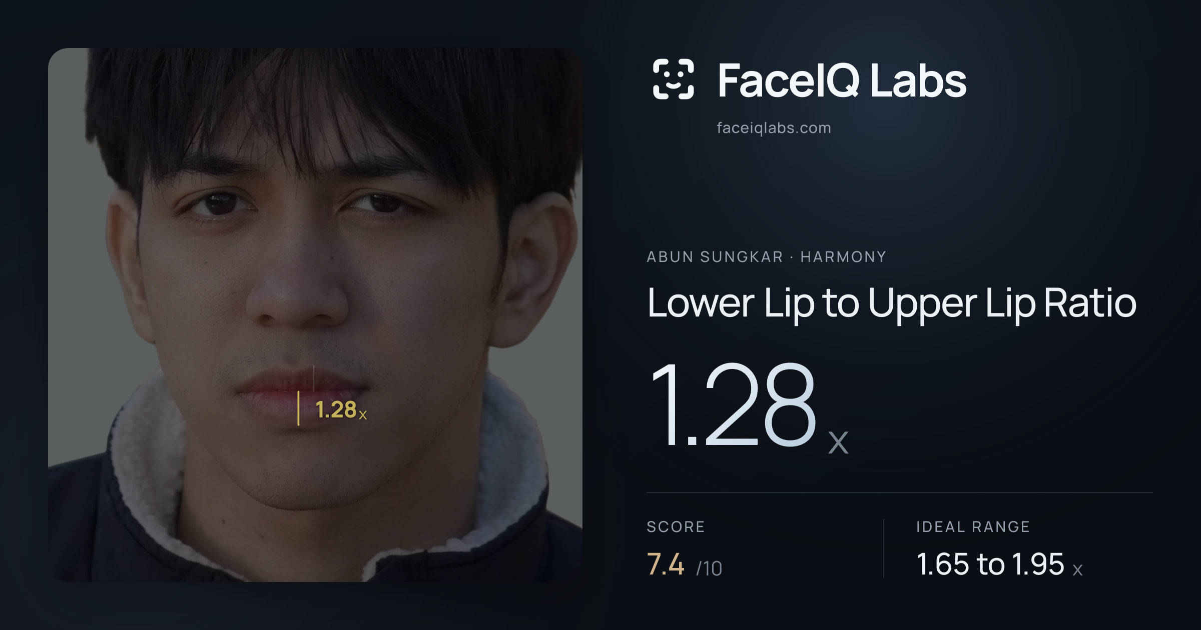 Abun Sungkar Lower Lip to Upper Lip Ratio: 1.28x, drawn on the photo