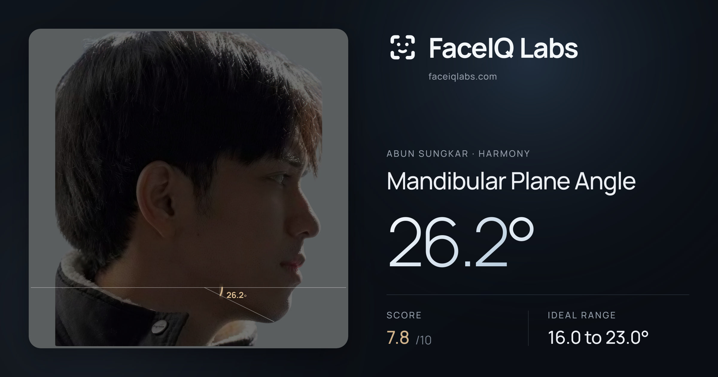 Abun Sungkar Mandibular Plane Angle: 26.2°, drawn on the photo