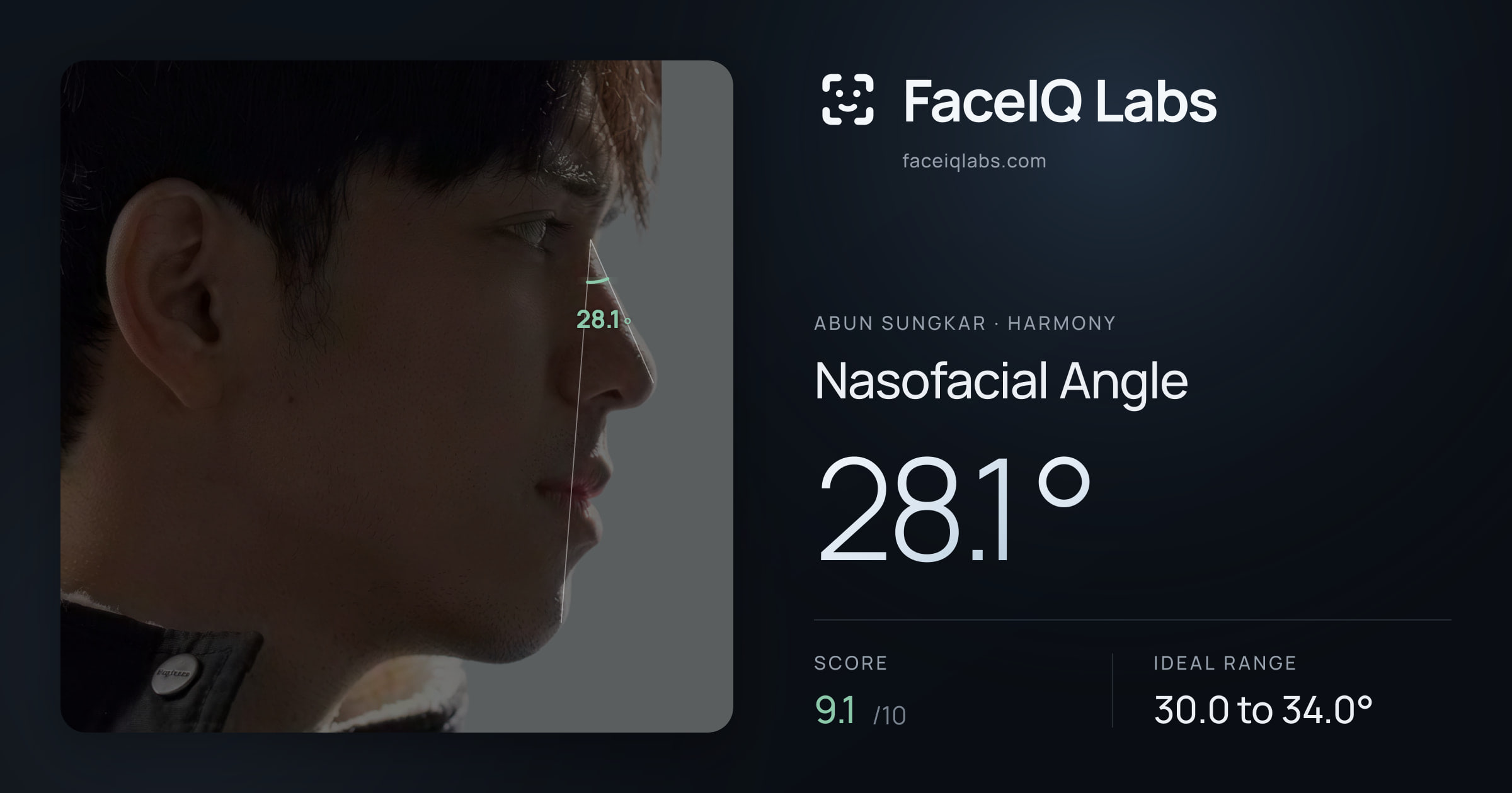 Abun Sungkar Nasofacial Angle: 28.1°, drawn on the photo