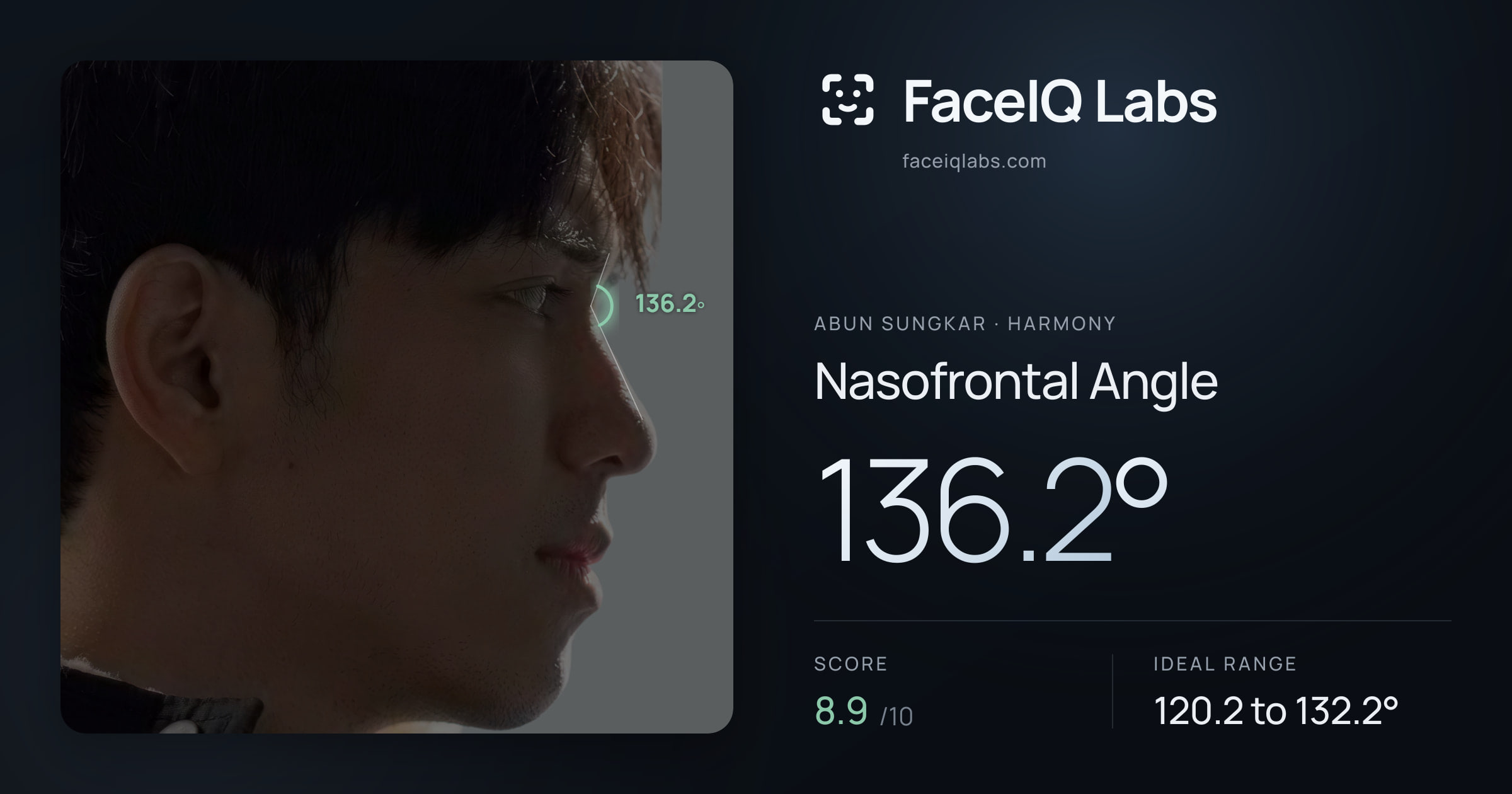 Abun Sungkar Nasofrontal Angle: 136.2°, drawn on the photo