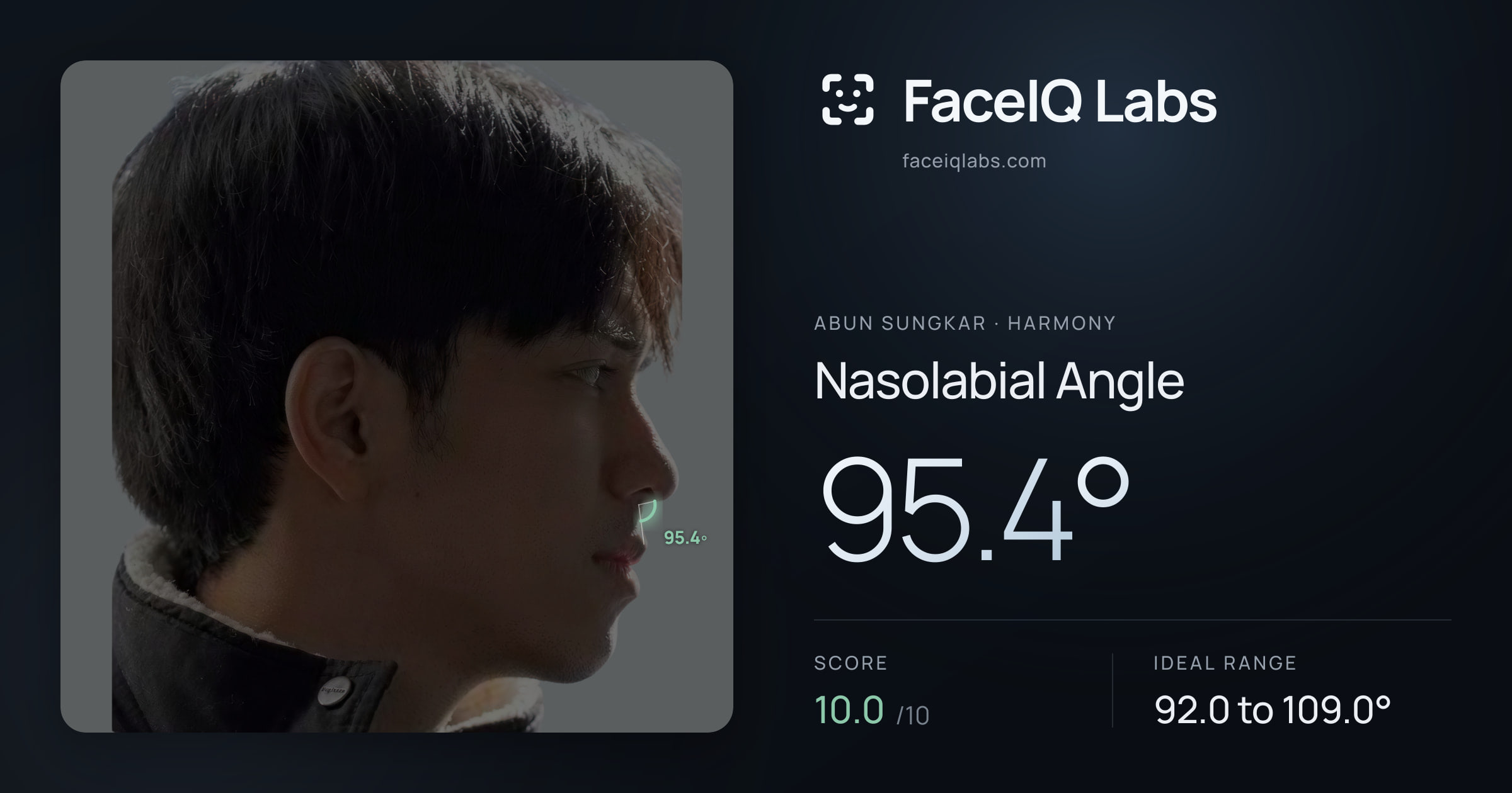 Abun Sungkar Nasolabial Angle: 95.4°, drawn on the photo