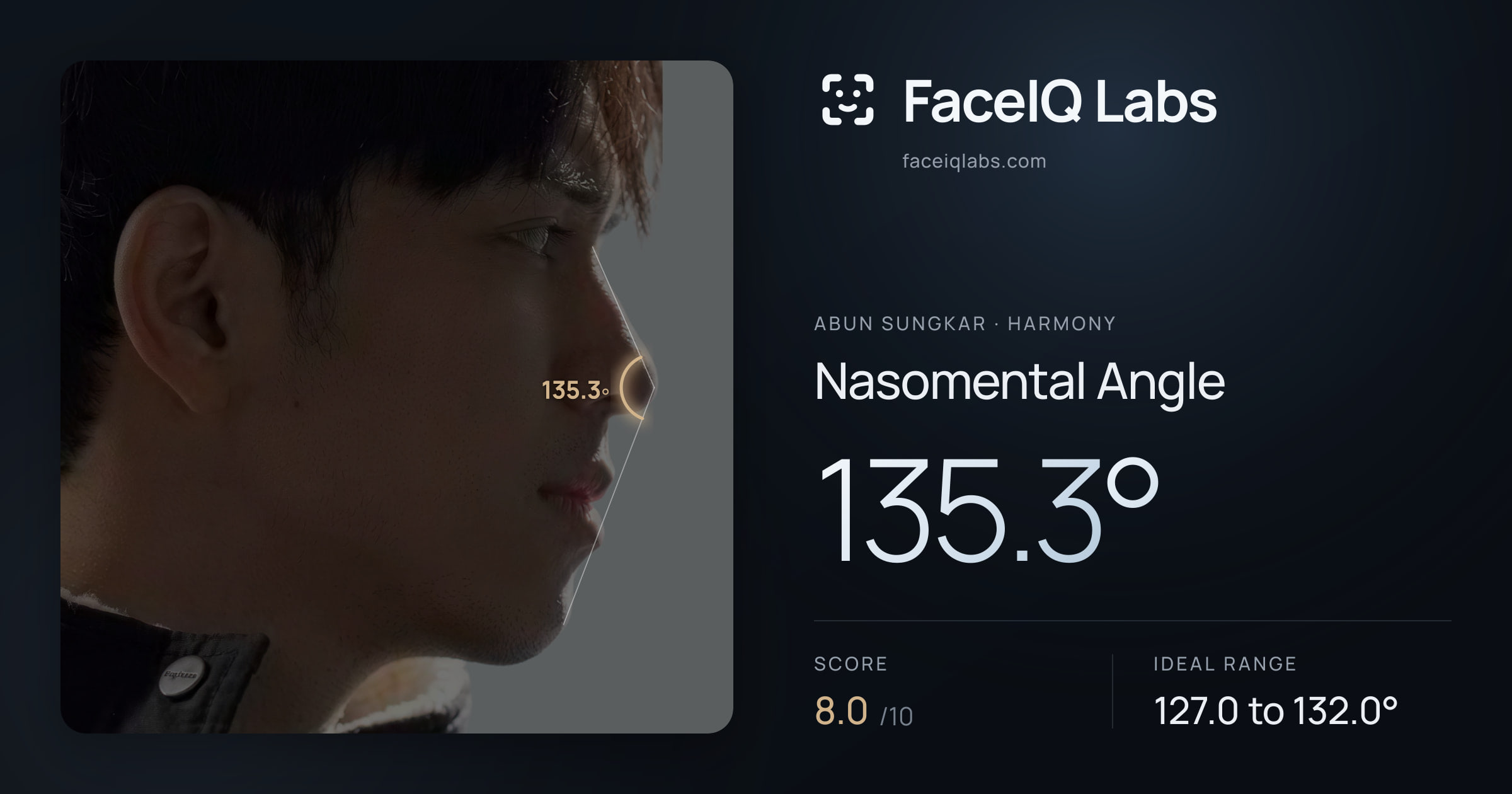 Abun Sungkar Nasomental Angle: 135.3°, drawn on the photo