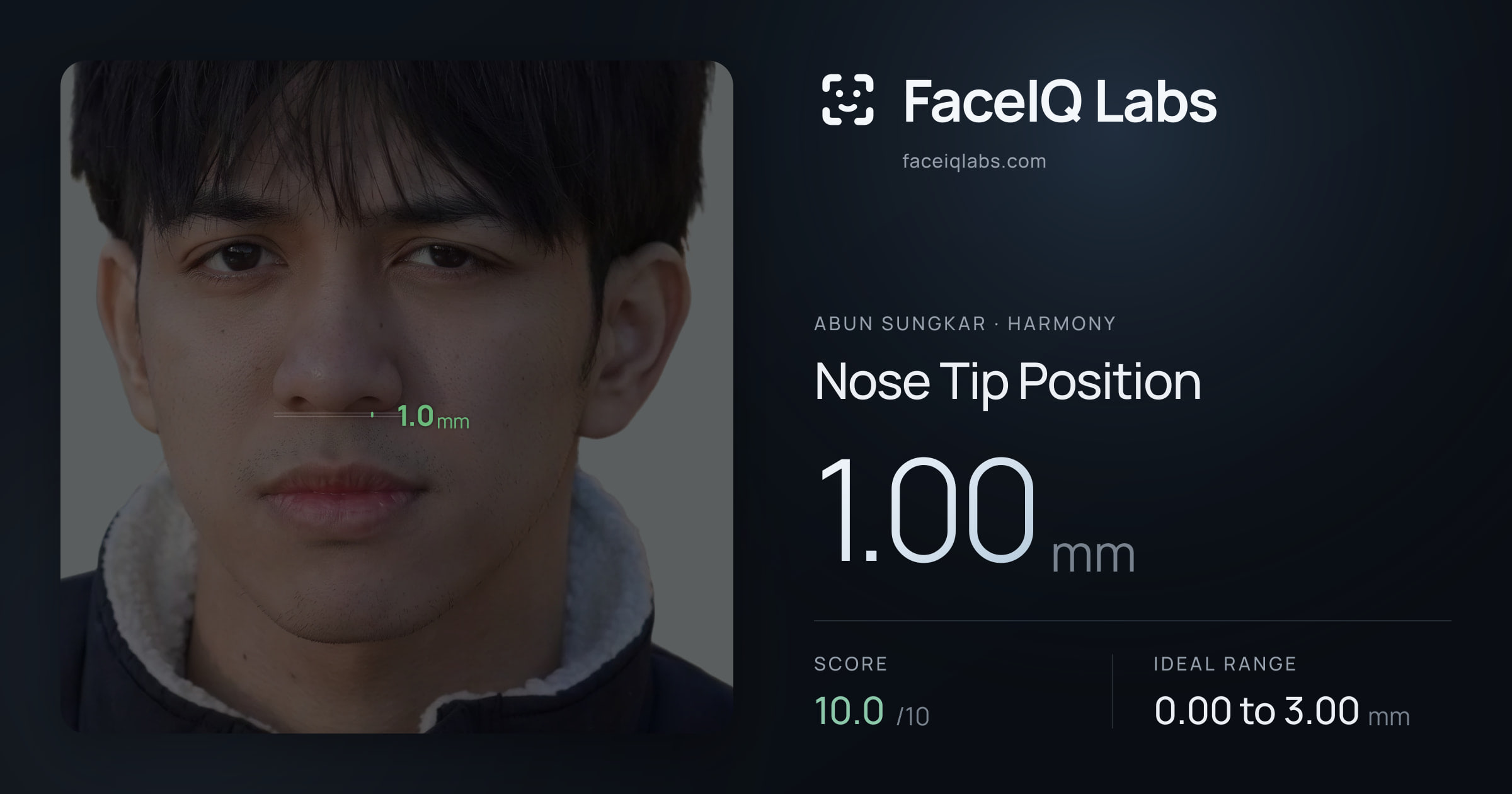 Abun Sungkar Nose Tip Position: 1.00mm, drawn on the photo