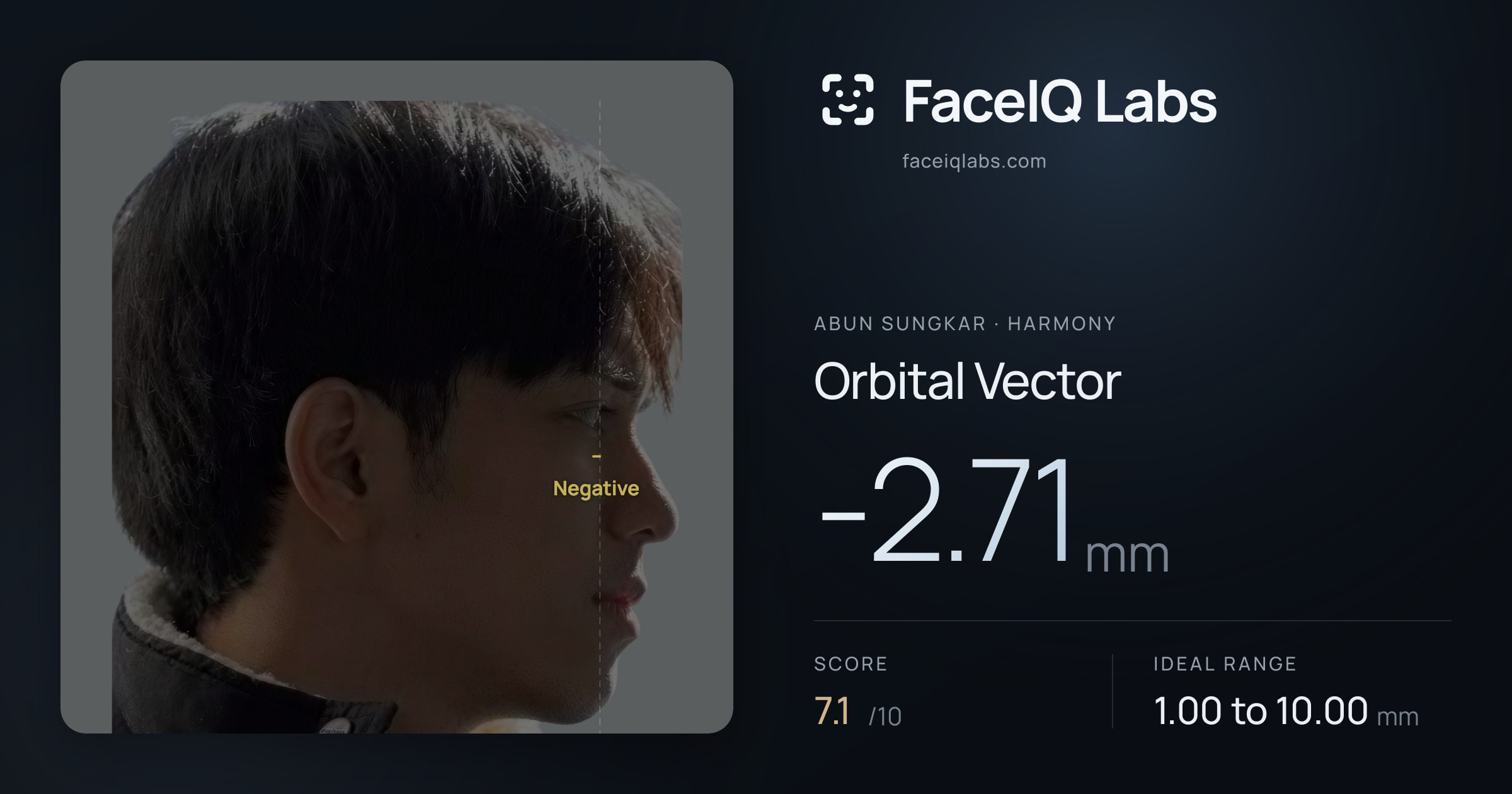 Abun Sungkar Orbital Vector: -2.71mm, drawn on the photo