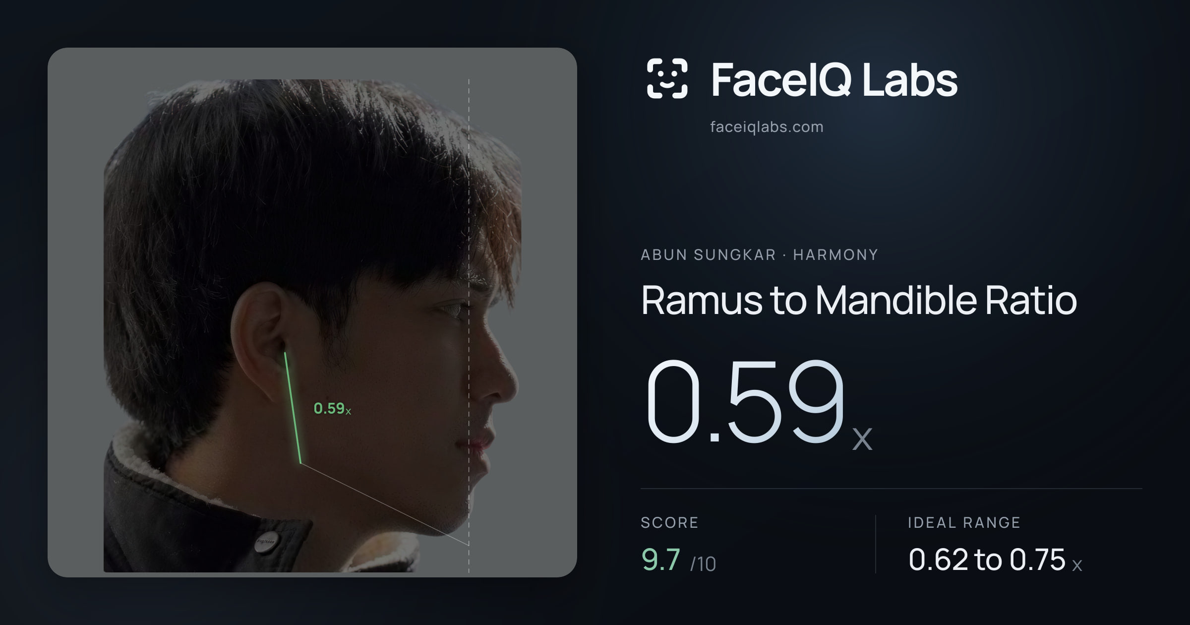 Abun Sungkar Ramus to Mandible Ratio: 0.59x, drawn on the photo