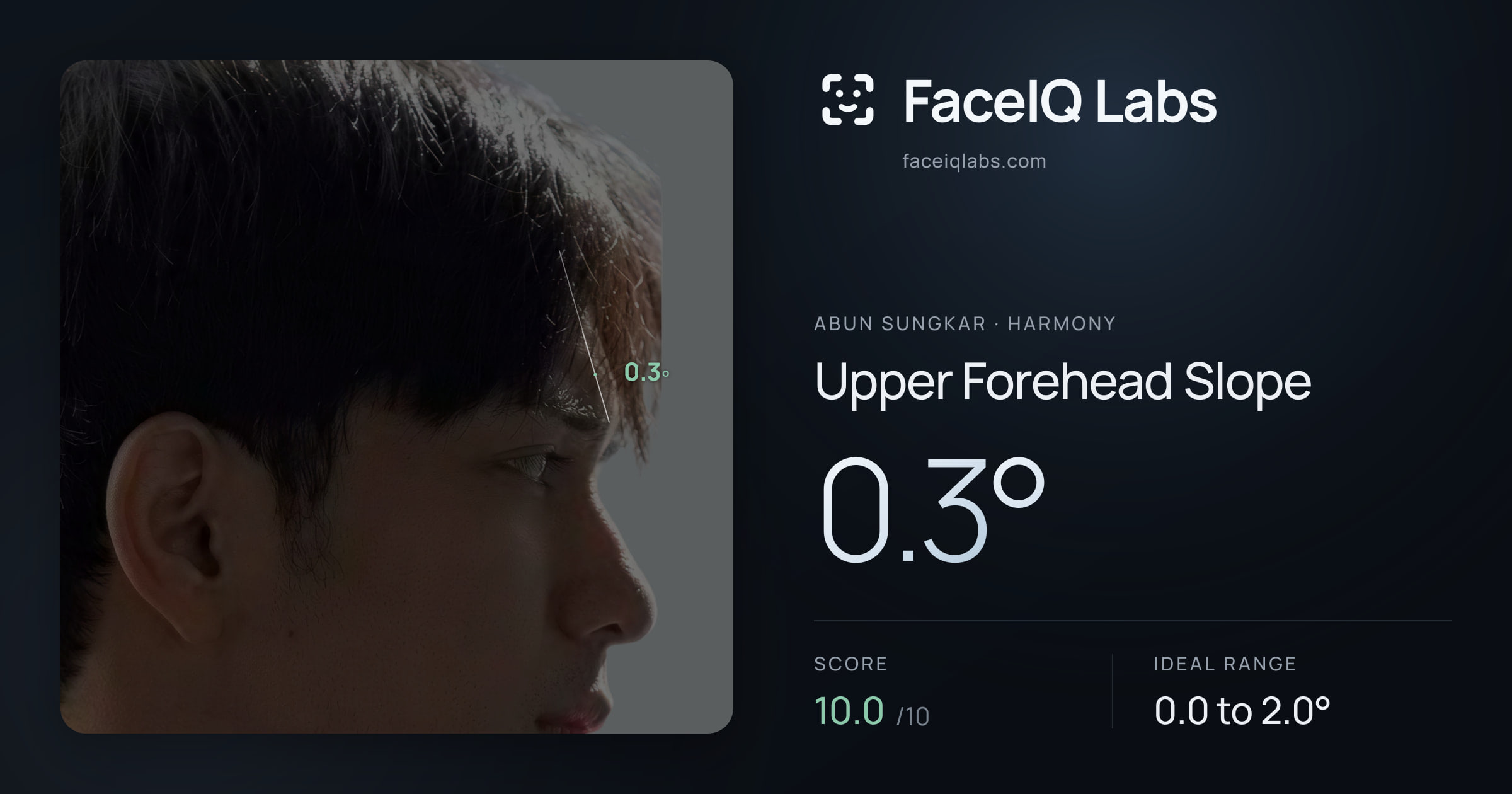 Abun Sungkar Upper Forehead Slope: 0.3°, drawn on the photo