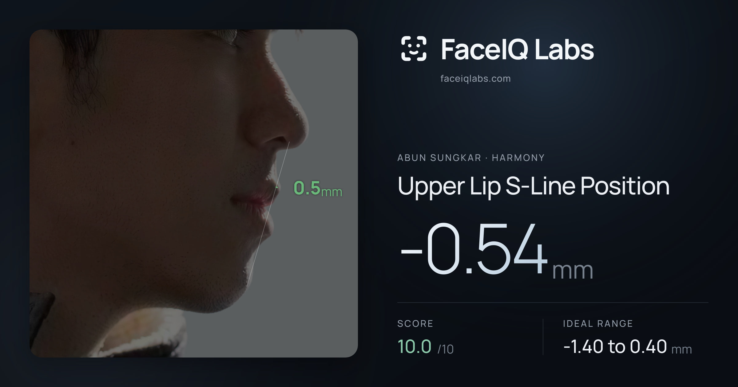Abun Sungkar Upper Lip S-Line Position: -0.54mm, drawn on the photo