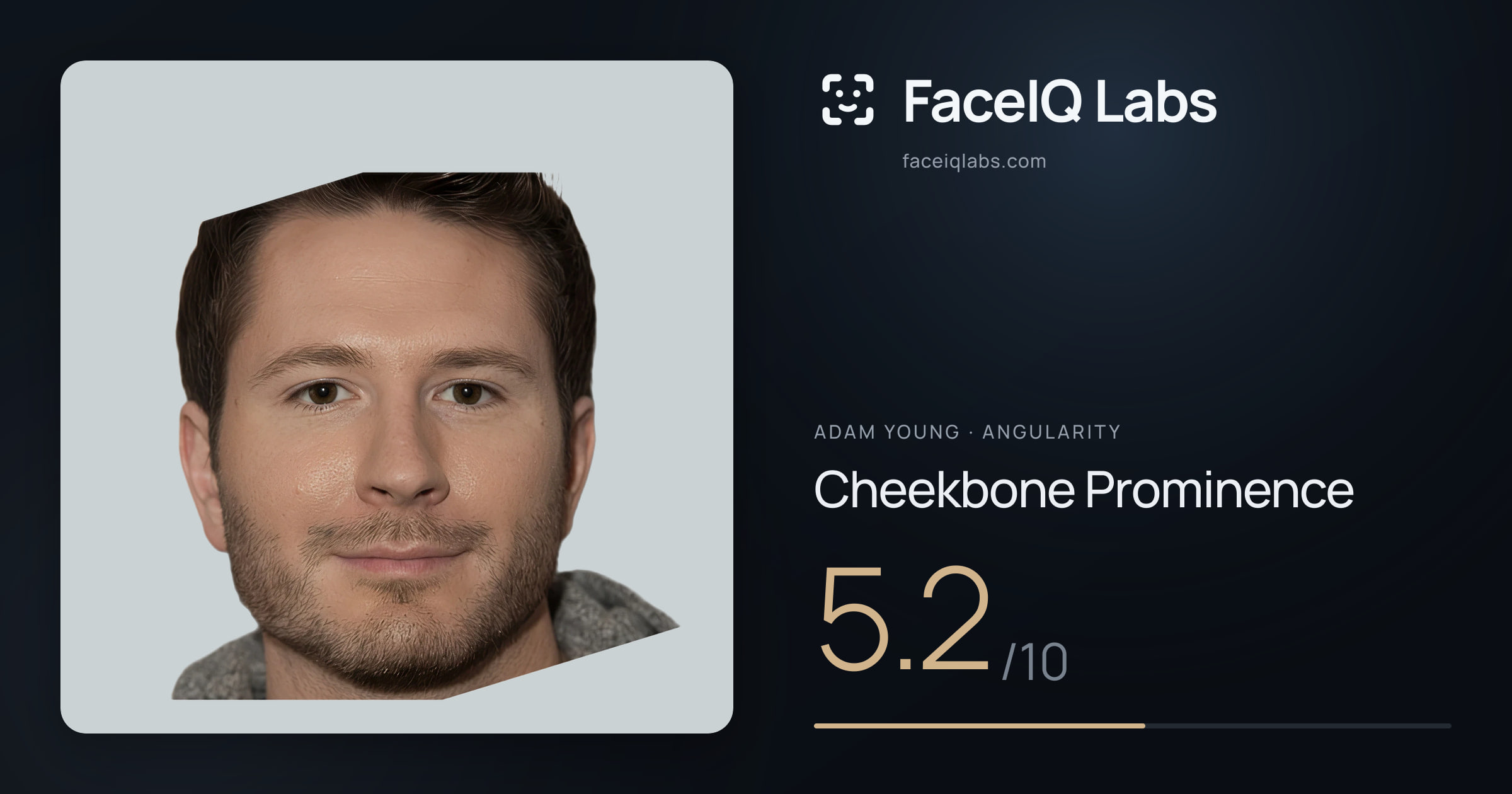 Adam Young Cheekbone Prominence: 5.2/10, drawn on the photo