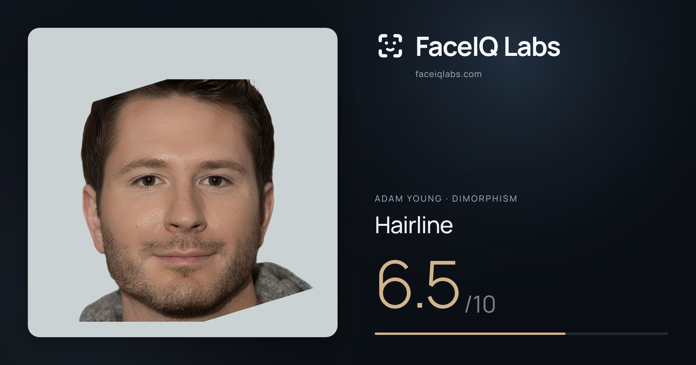Adam Young Hairline: 6.5/10, drawn on the photo