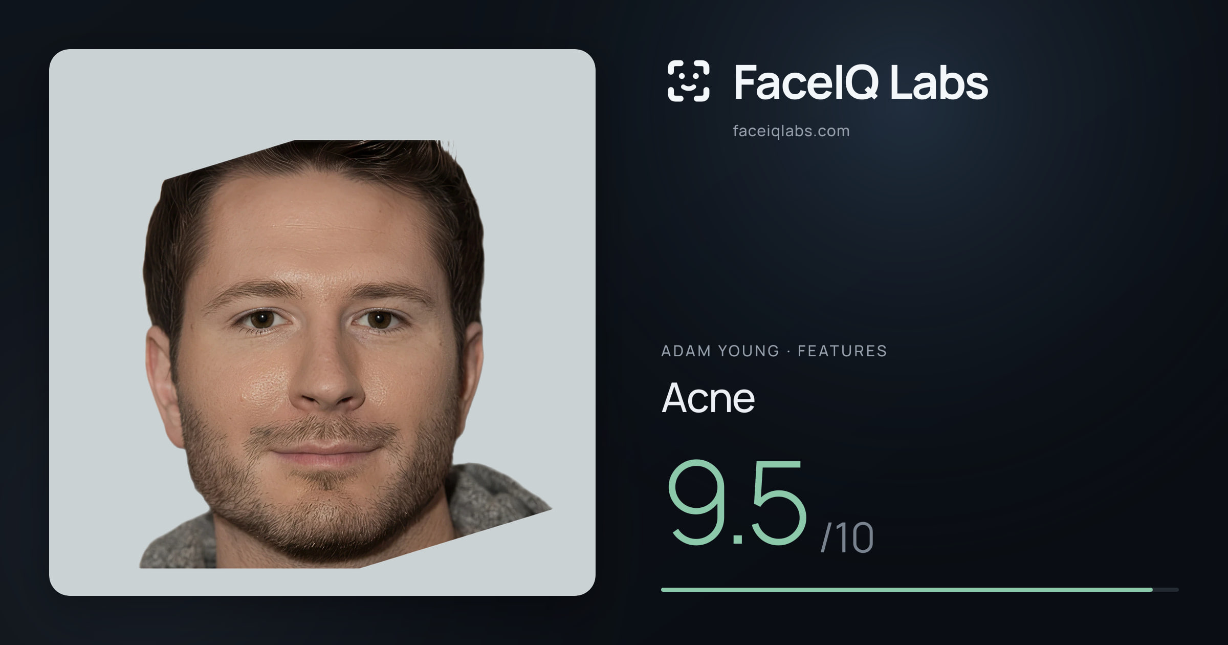 Adam Young Acne: 9.5/10, drawn on the photo