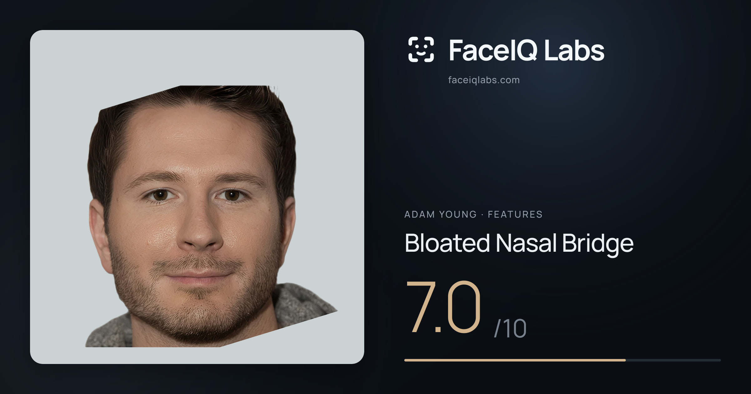 Adam Young Bloated Nasal Bridge: 7.0/10, drawn on the photo