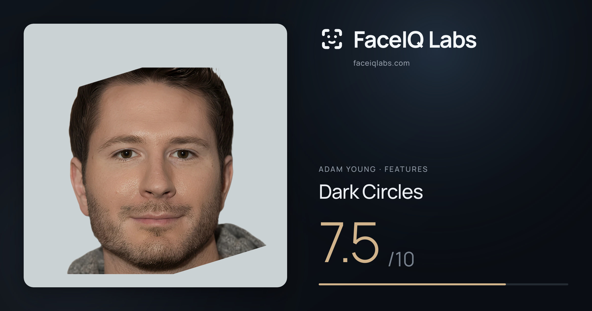 Adam Young Dark Circles: 7.5/10, drawn on the photo