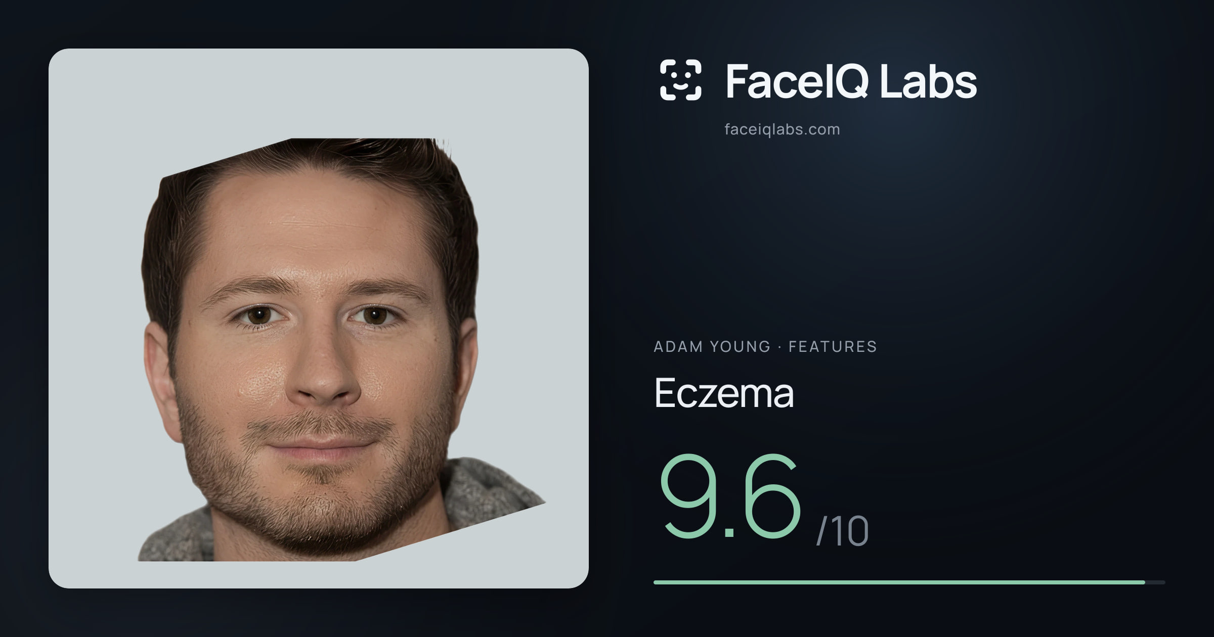 Adam Young Eczema: 9.6/10, drawn on the photo