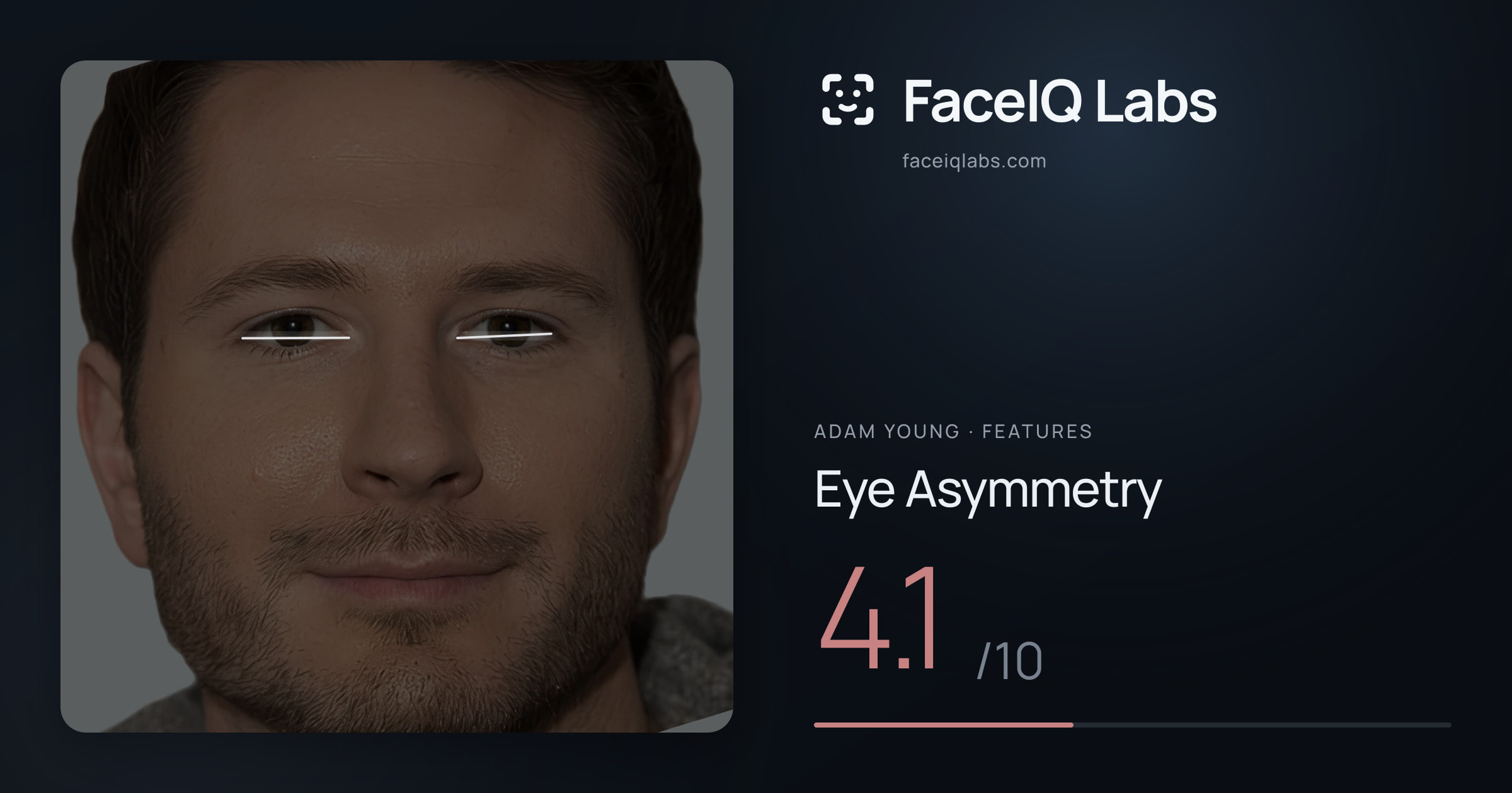 Adam Young Eye Asymmetry: 4.1/10, drawn on the photo