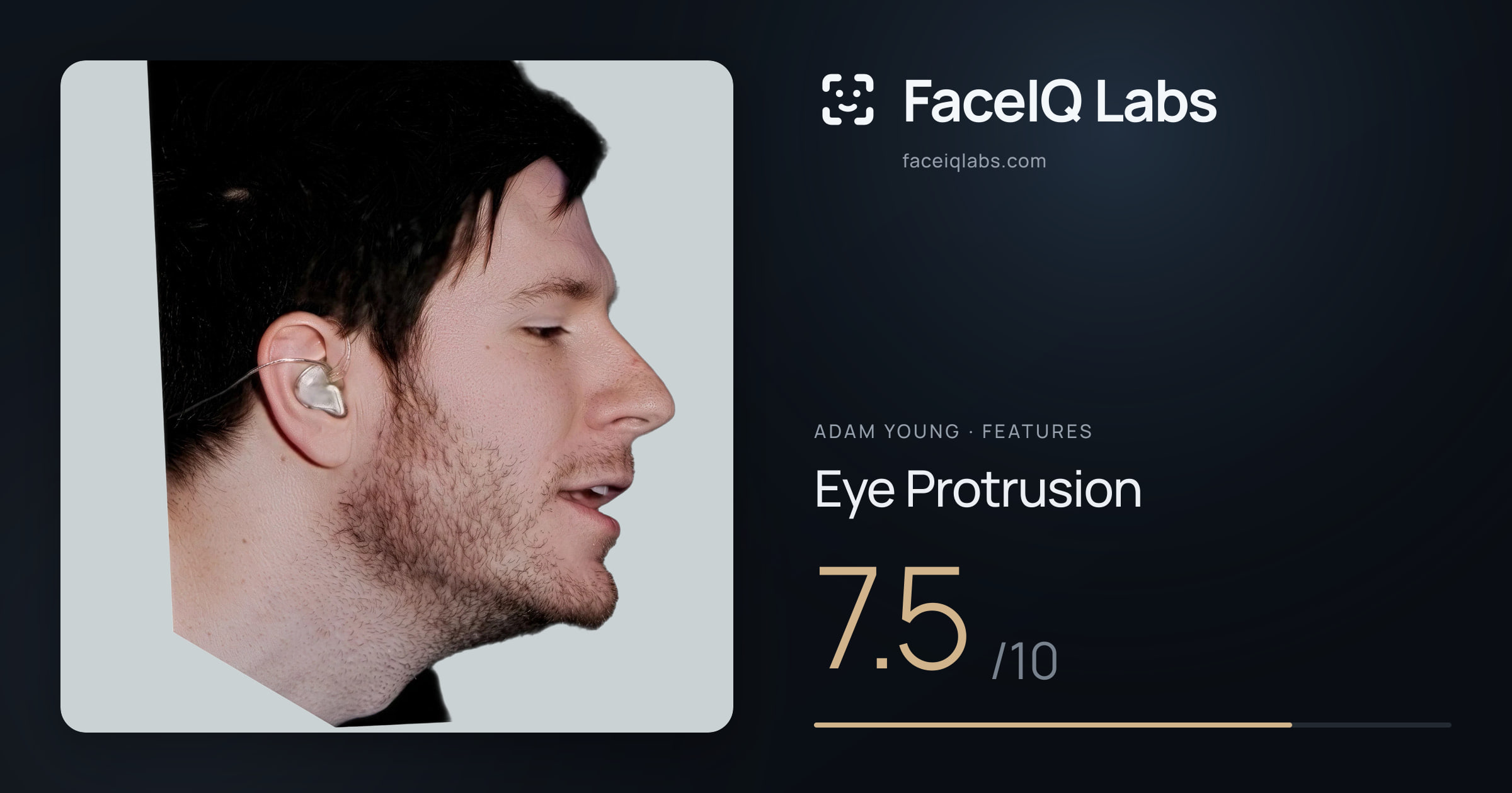 Adam Young Eye Protrusion: 7.5/10, drawn on the photo