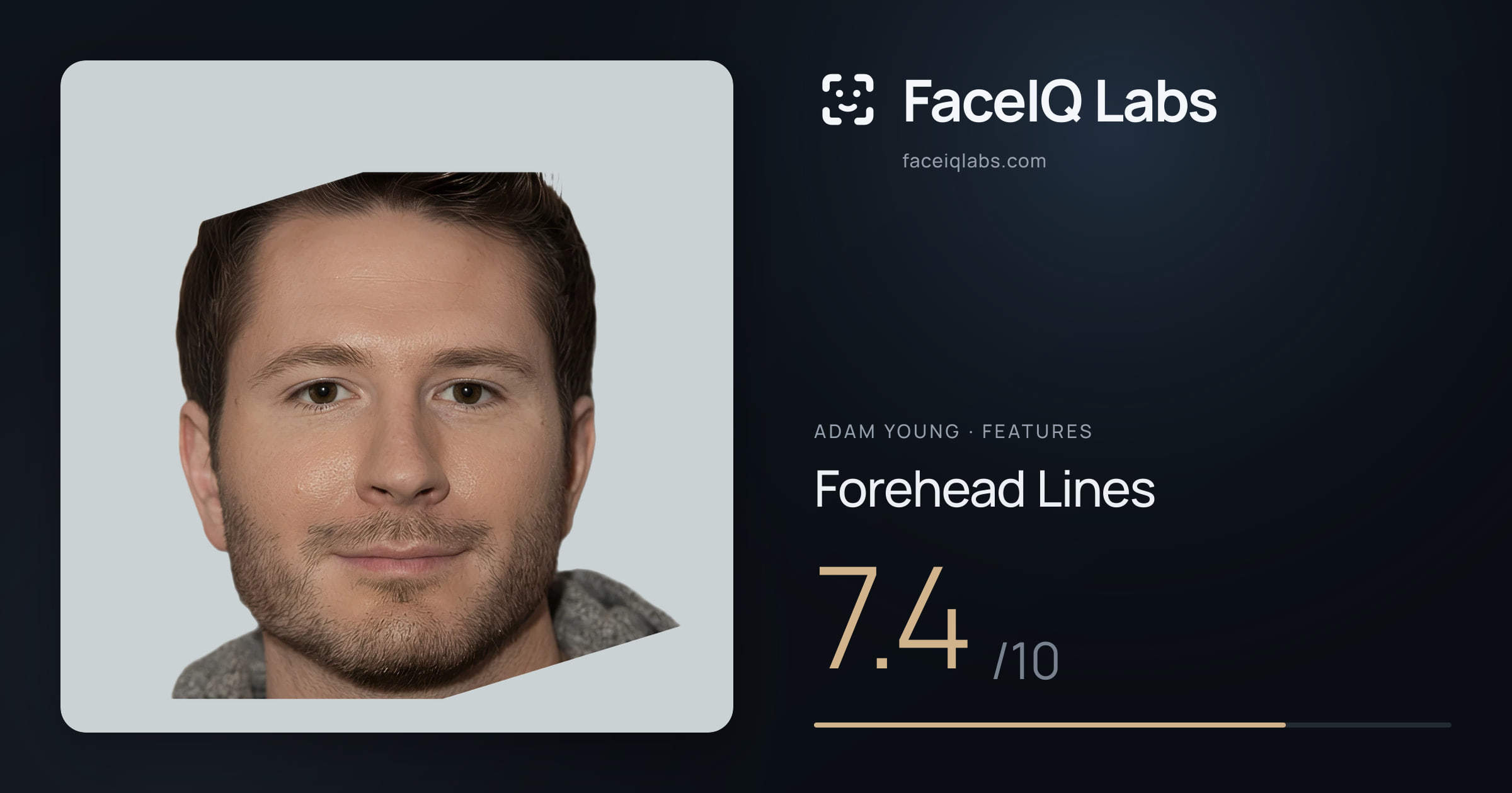Adam Young Forehead Lines: 7.4/10, drawn on the photo