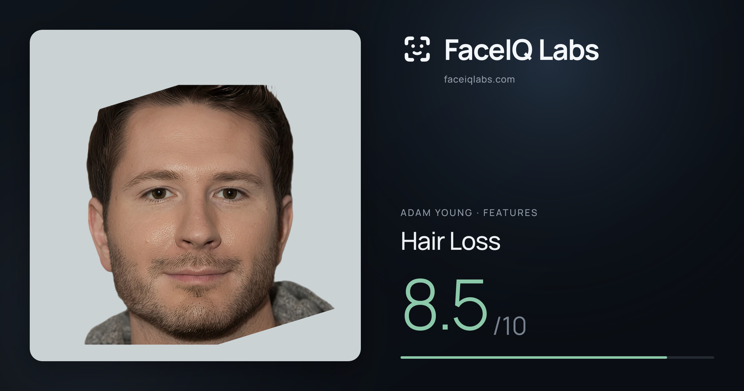 Adam Young Hair Loss: 8.5/10, drawn on the photo