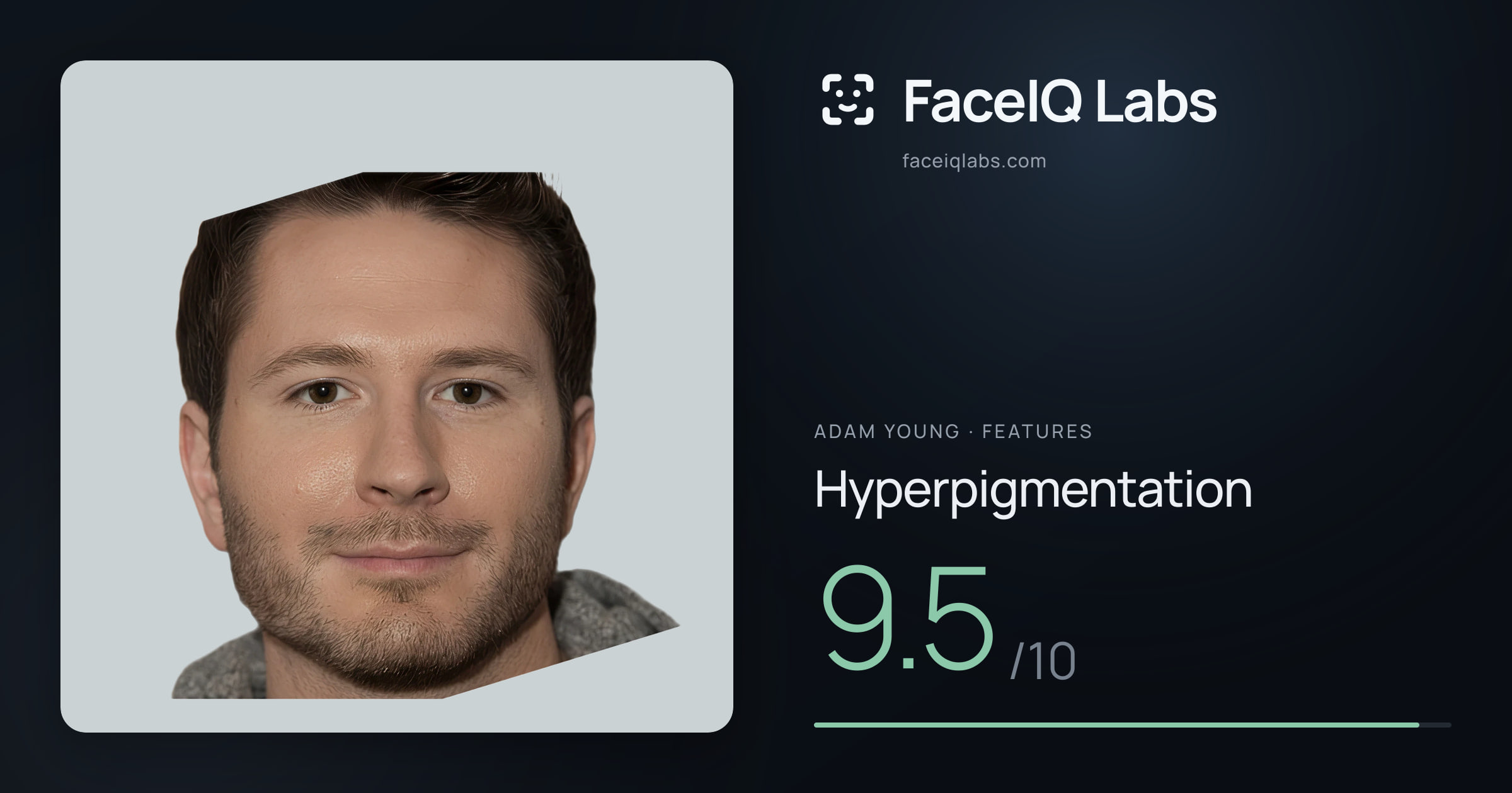 Adam Young Hyperpigmentation: 9.5/10, drawn on the photo