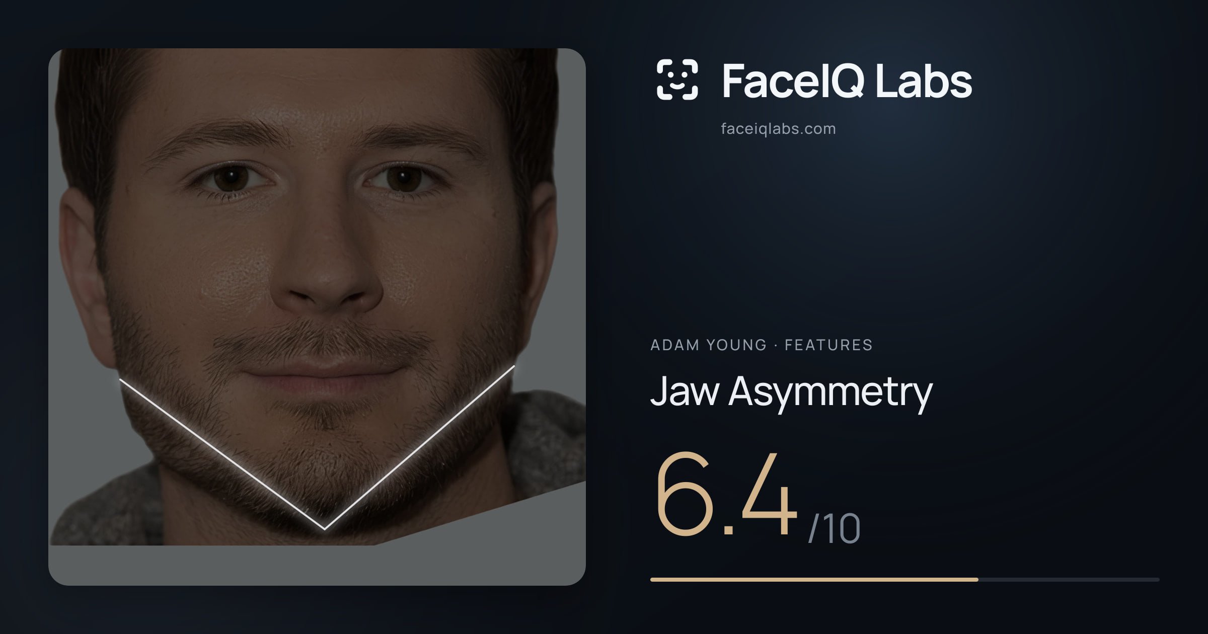 Adam Young Jaw Asymmetry: 6.4/10, drawn on the photo