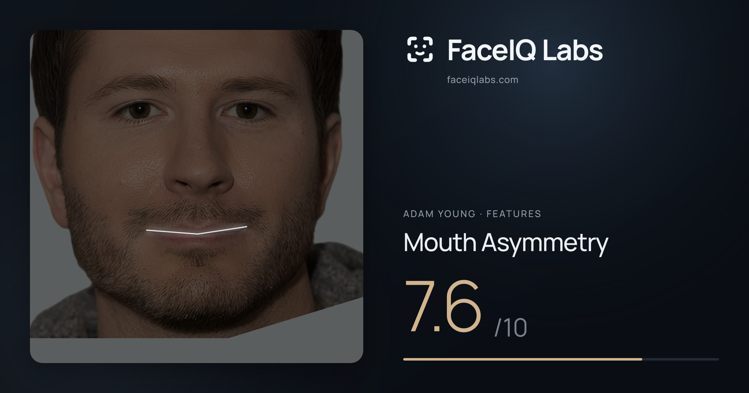 Adam Young Mouth Asymmetry: 7.6/10, drawn on the photo