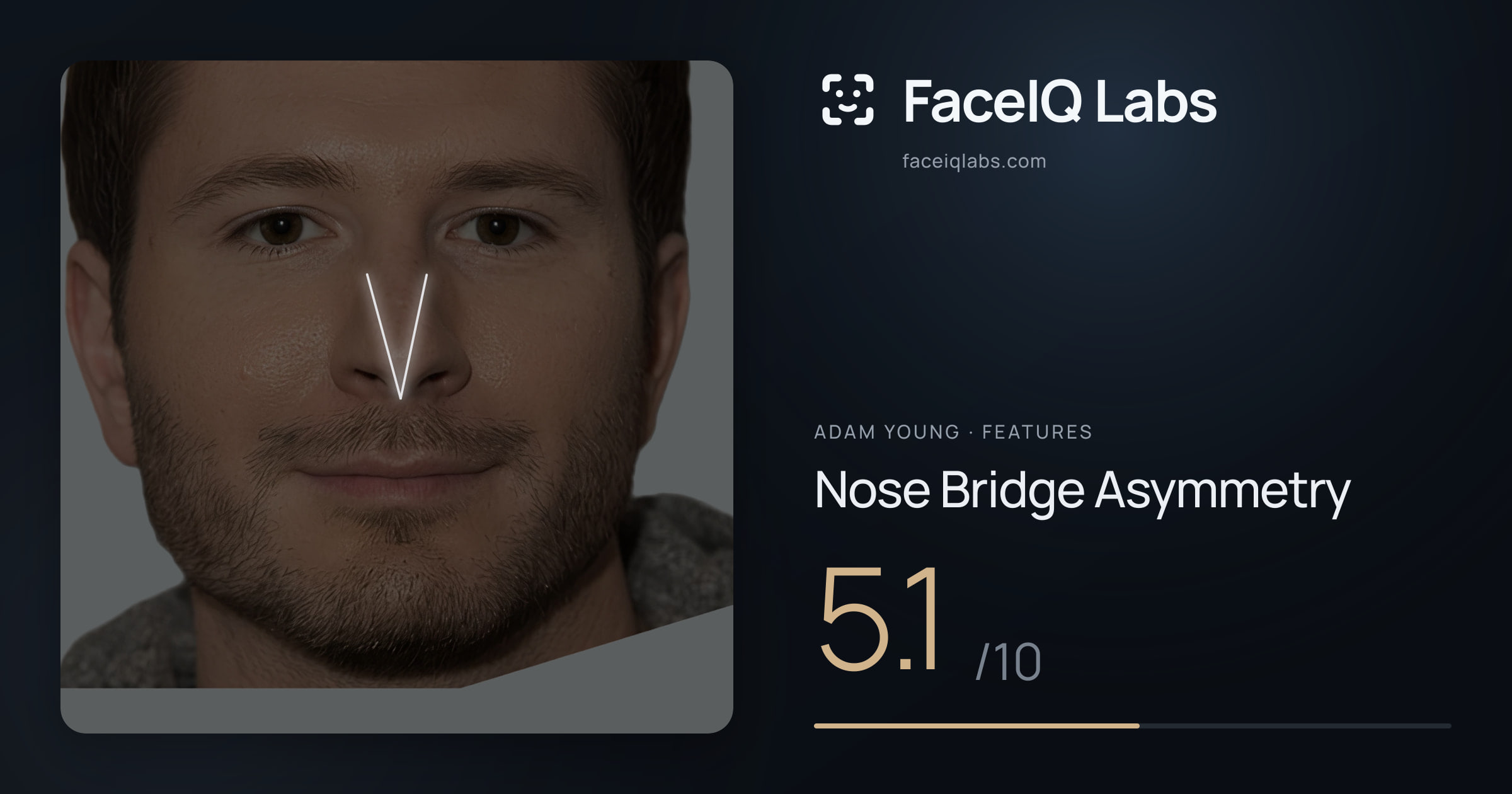 Adam Young Nose Bridge Asymmetry: 5.1/10, drawn on the photo