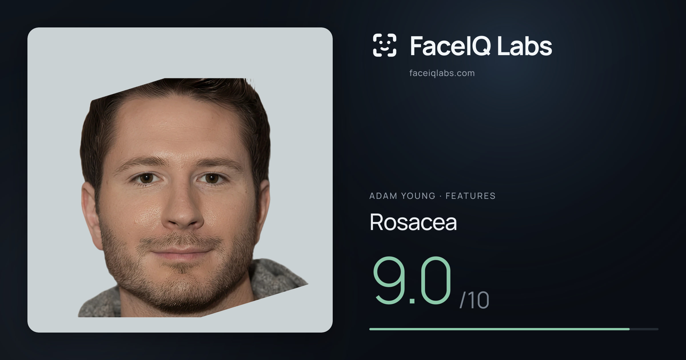 Adam Young Rosacea: 9.0/10, drawn on the photo