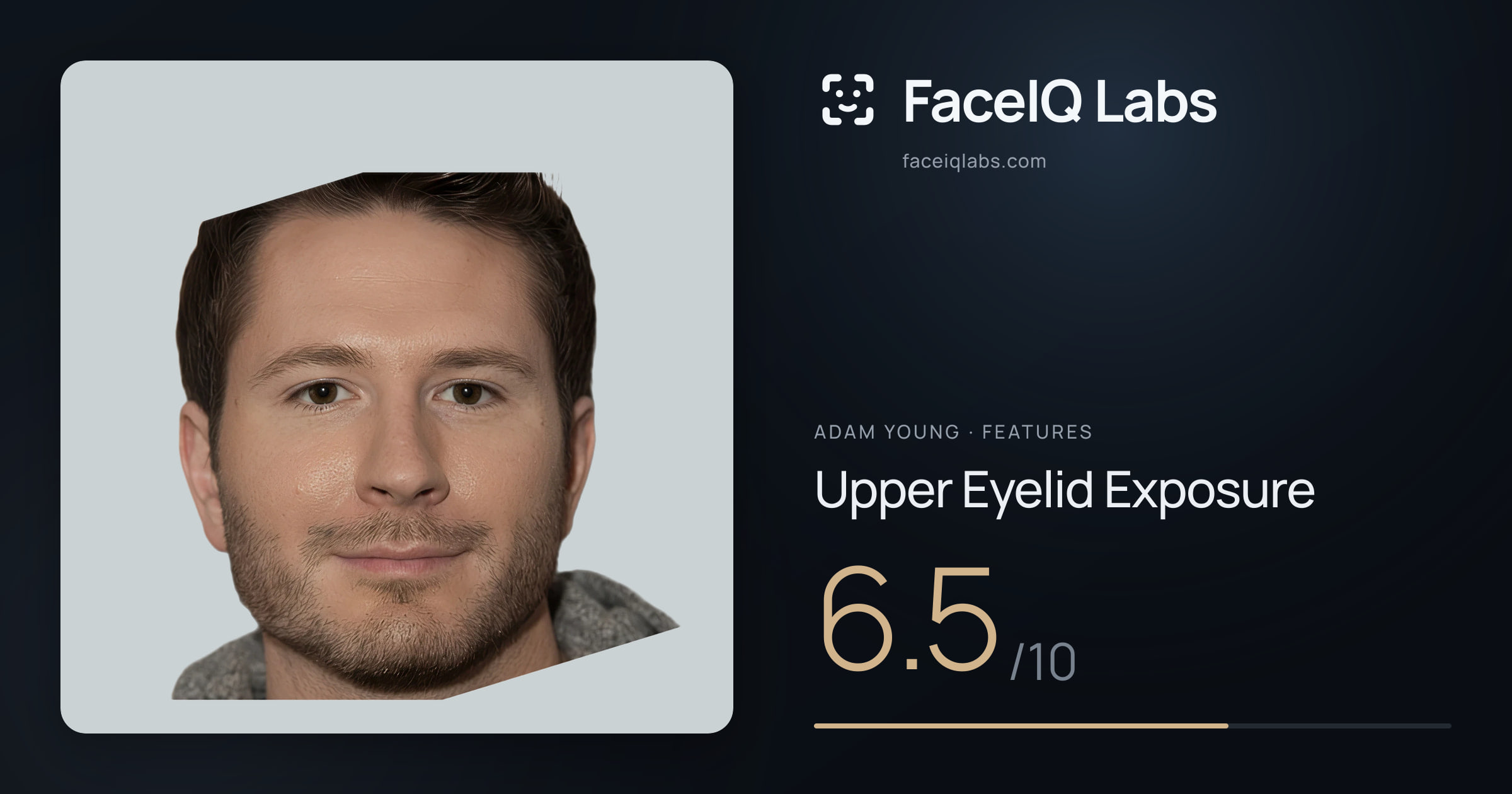 Adam Young Upper Eyelid Exposure: 6.5/10, drawn on the photo