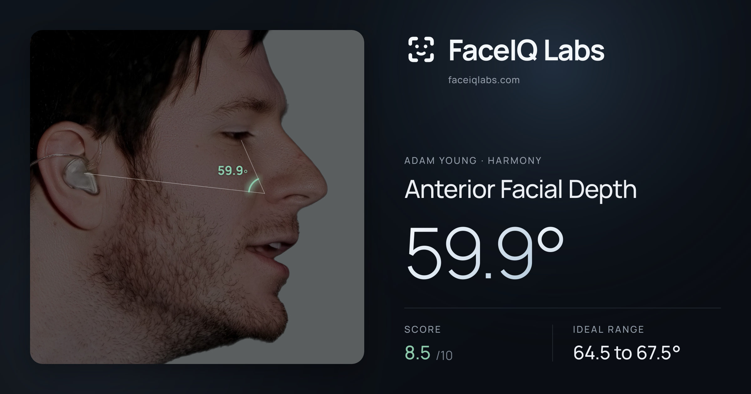 Adam Young Anterior Facial Depth: 59.9°, drawn on the photo