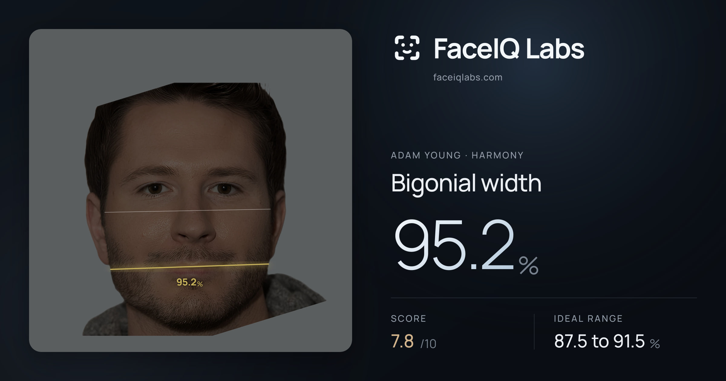 Adam Young Bigonial width: 95.2%, drawn on the photo
