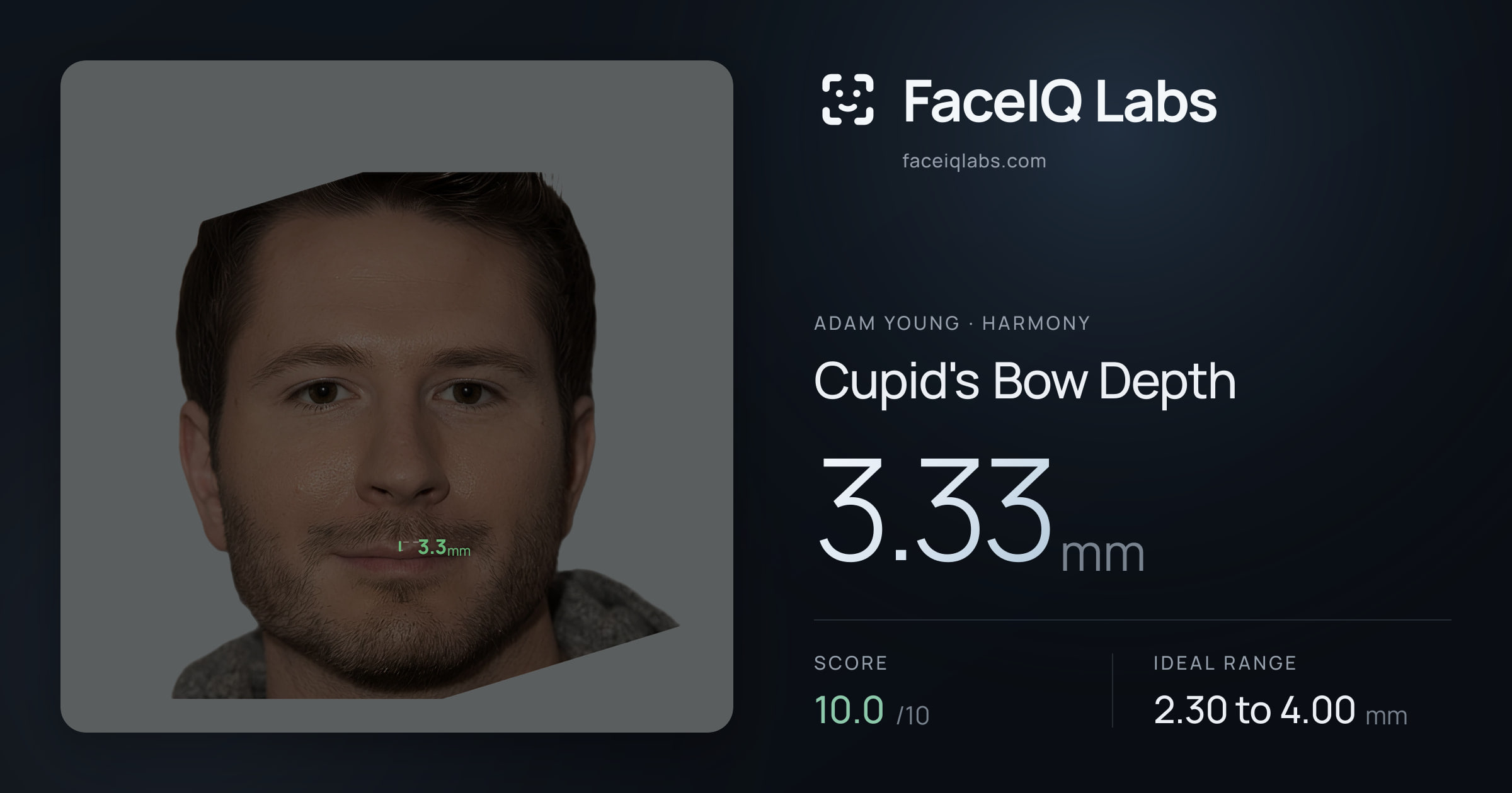 Adam Young Cupid's Bow Depth: 3.33mm, drawn on the photo