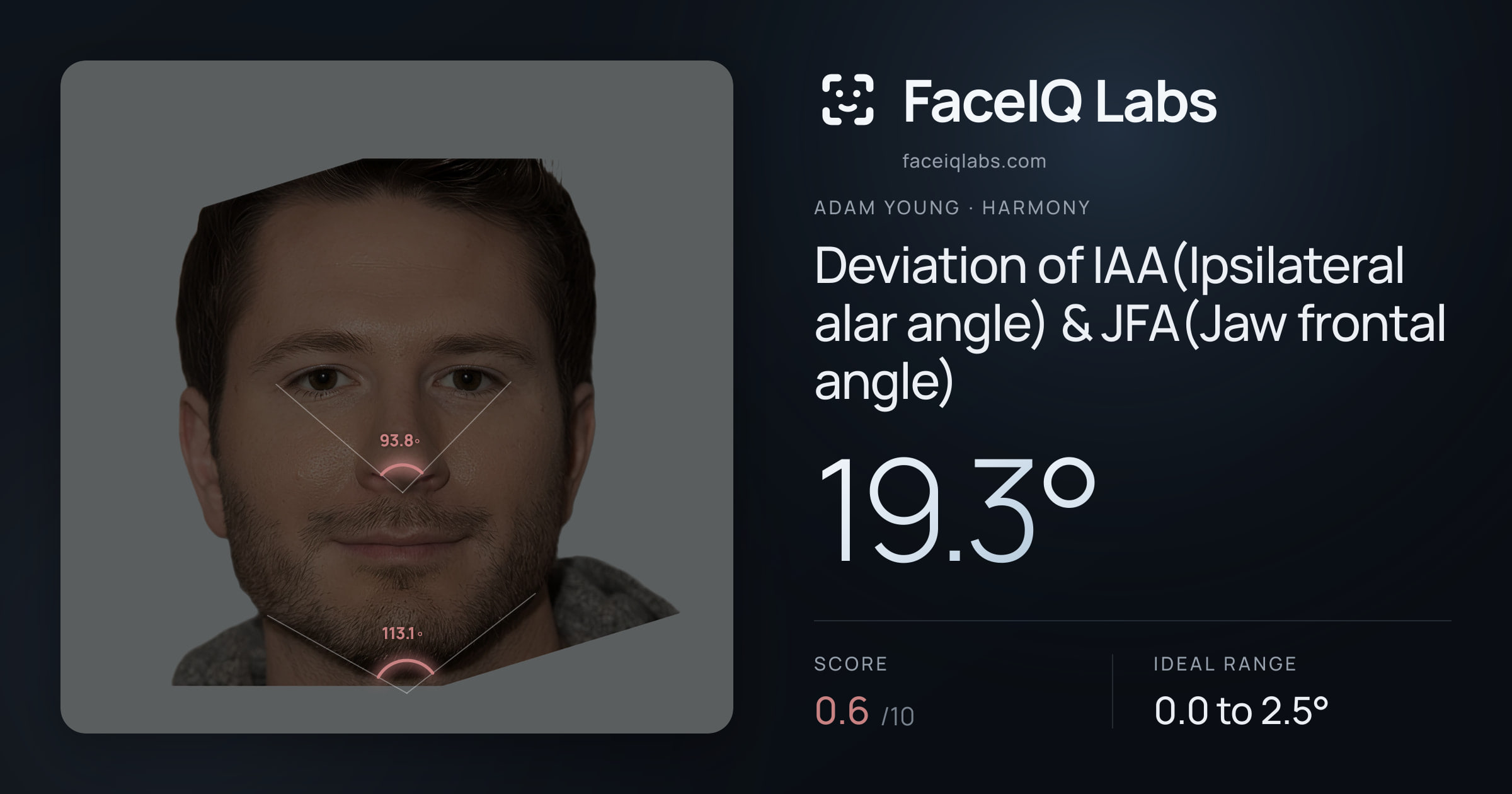 Adam Young Deviation of IAA(Ipsilateral alar angle) & JFA(Jaw frontal angle): 19.3°, drawn on the photo