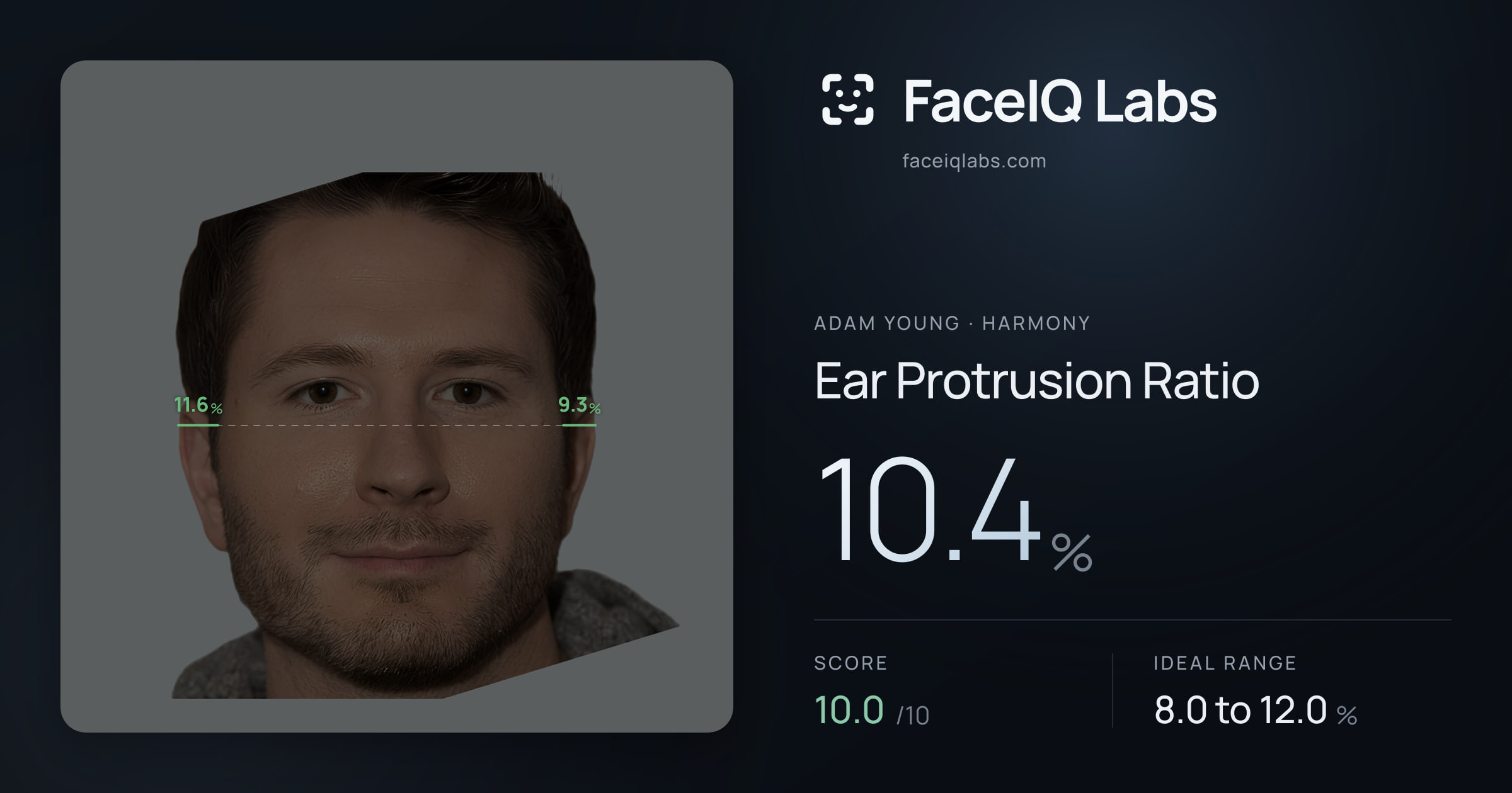 Adam Young Ear Protrusion Ratio: 10.4%, drawn on the photo