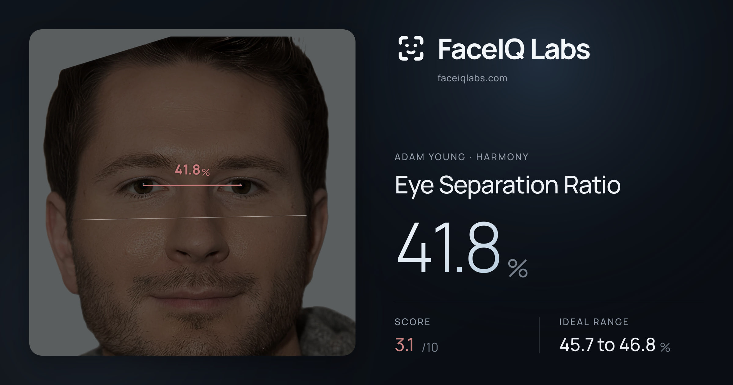 Adam Young Eye Separation Ratio: 41.8%, drawn on the photo