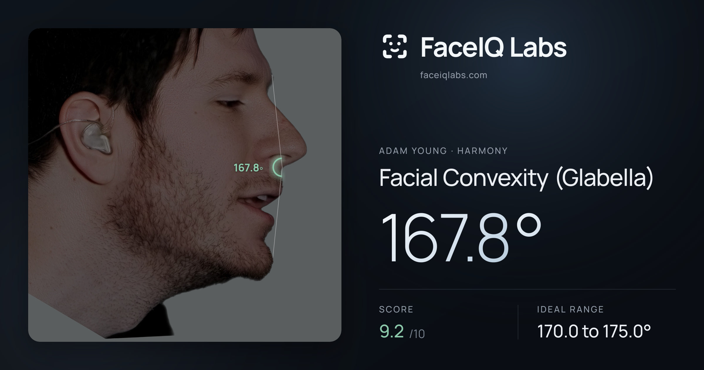 Adam Young Facial Convexity (Glabella): 167.8°, drawn on the photo