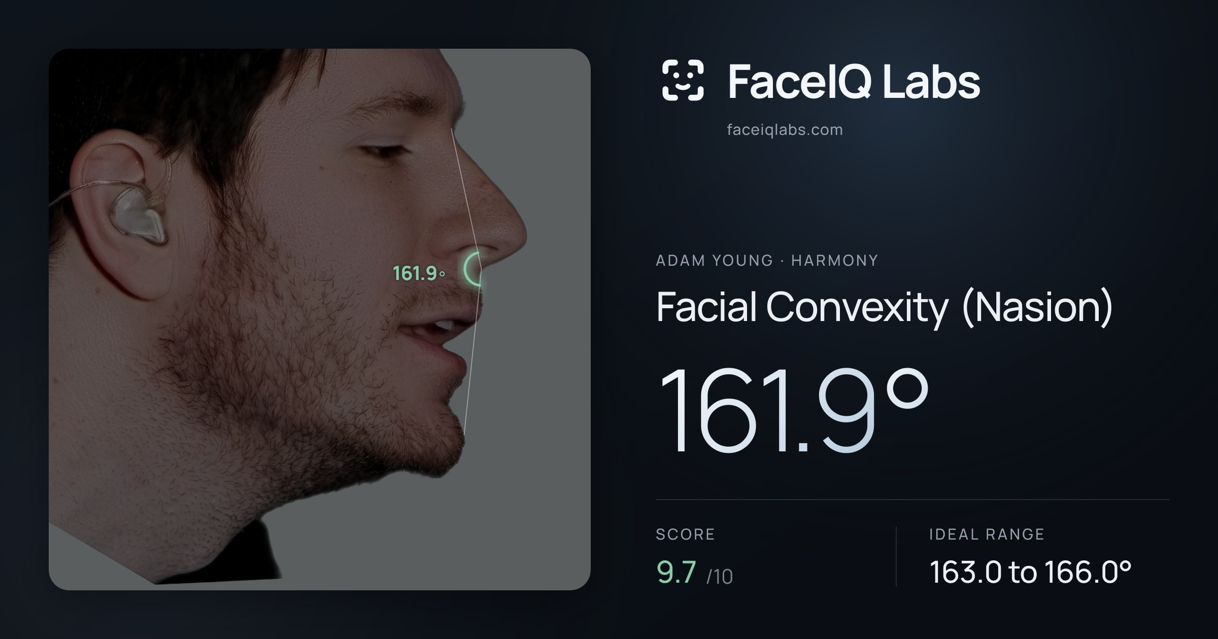 Adam Young Facial Convexity (Nasion): 161.9°, drawn on the photo