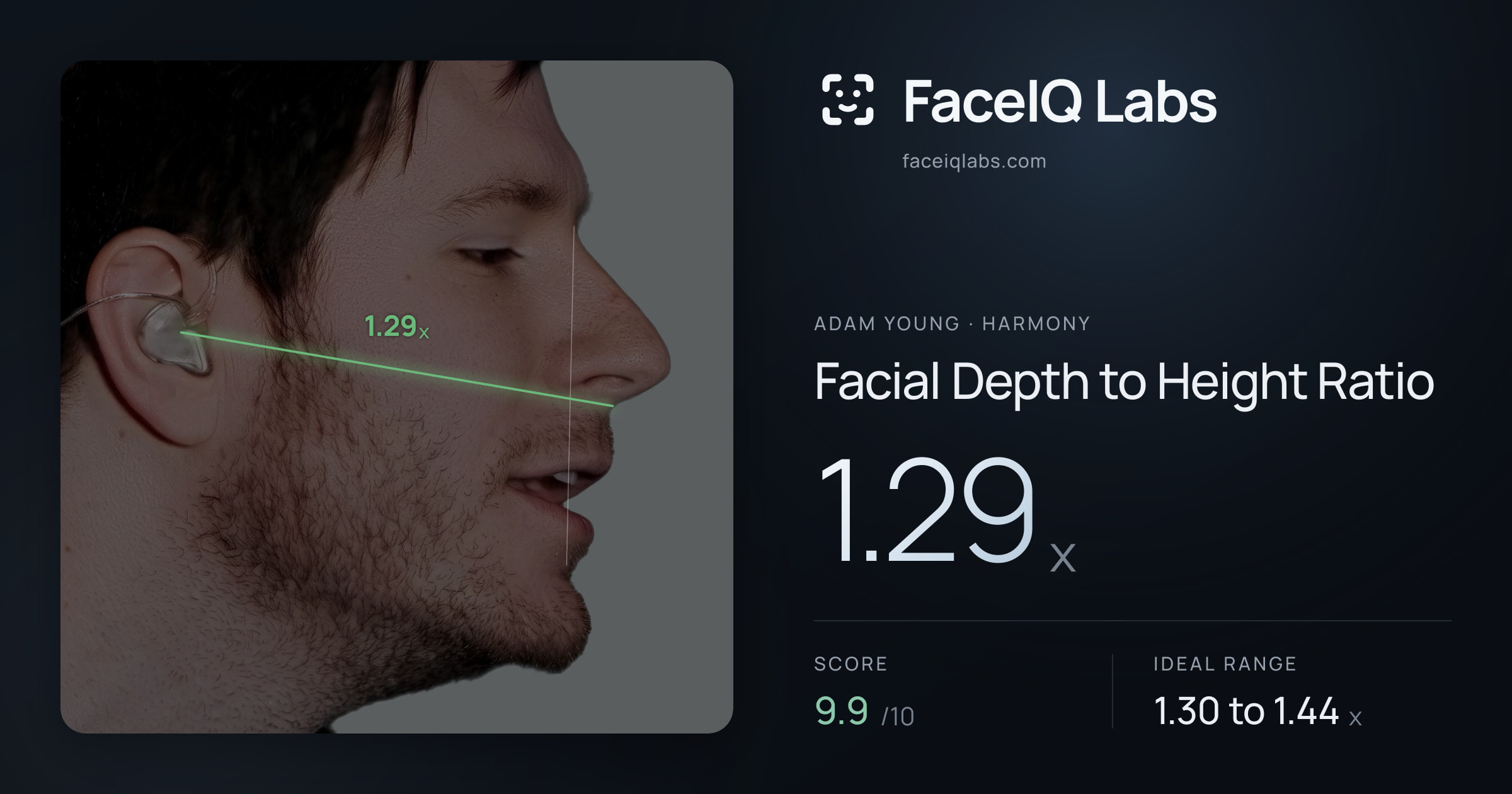 Adam Young Facial Depth to Height Ratio: 1.29x, drawn on the photo