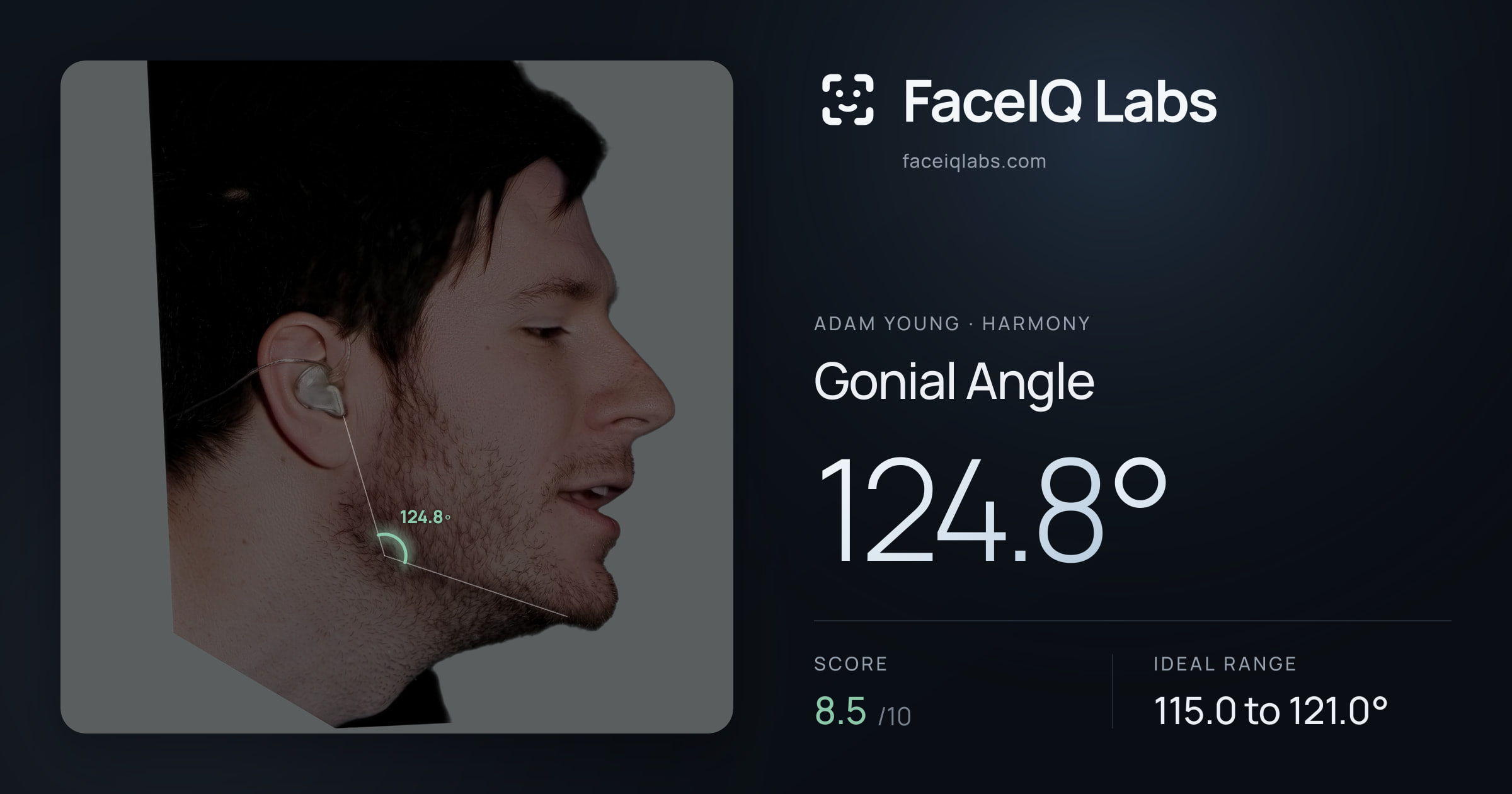 Adam Young Gonial Angle: 124.8°, drawn on the photo