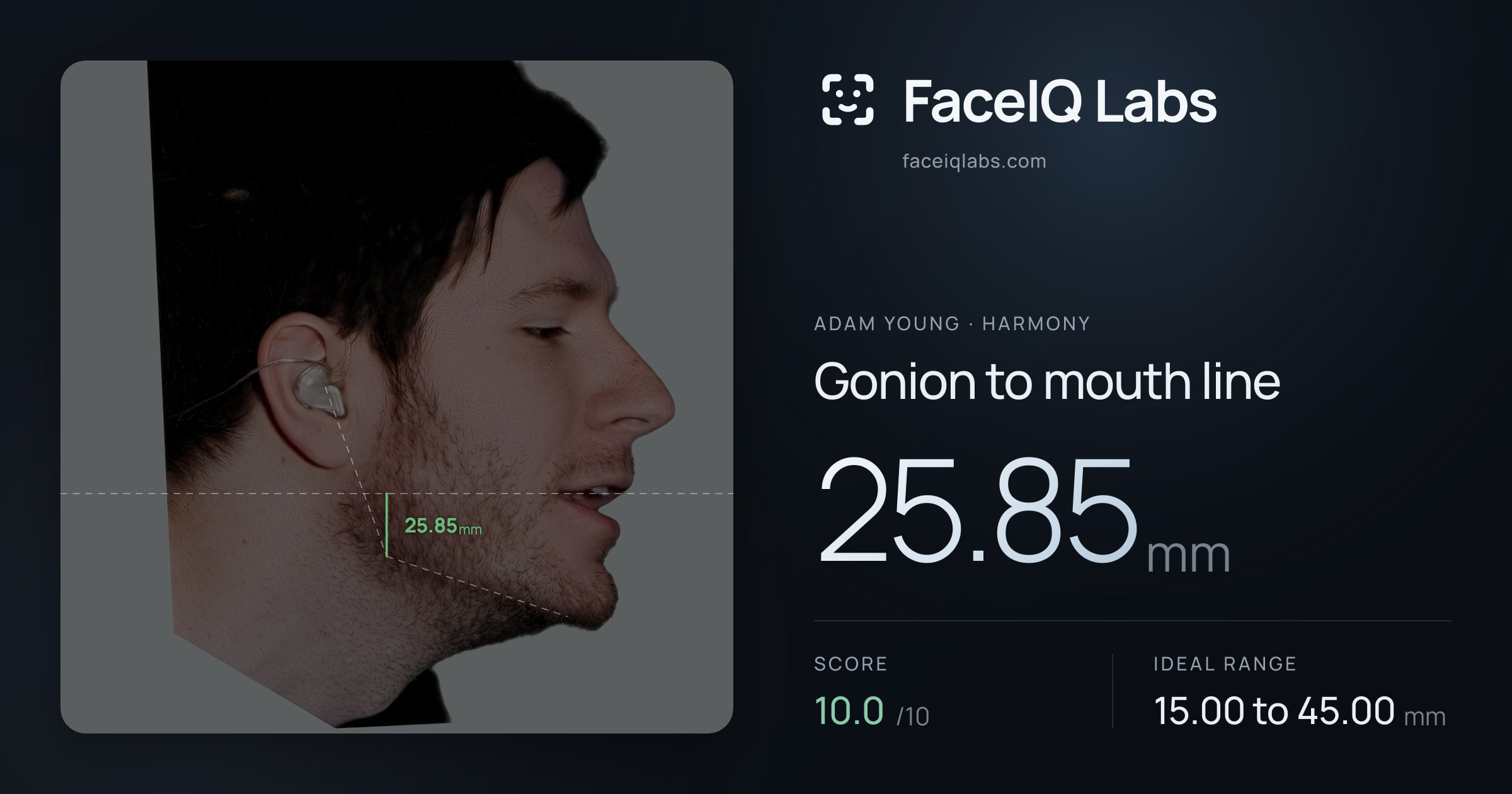 Adam Young Gonion to mouth line: 25.85mm, drawn on the photo