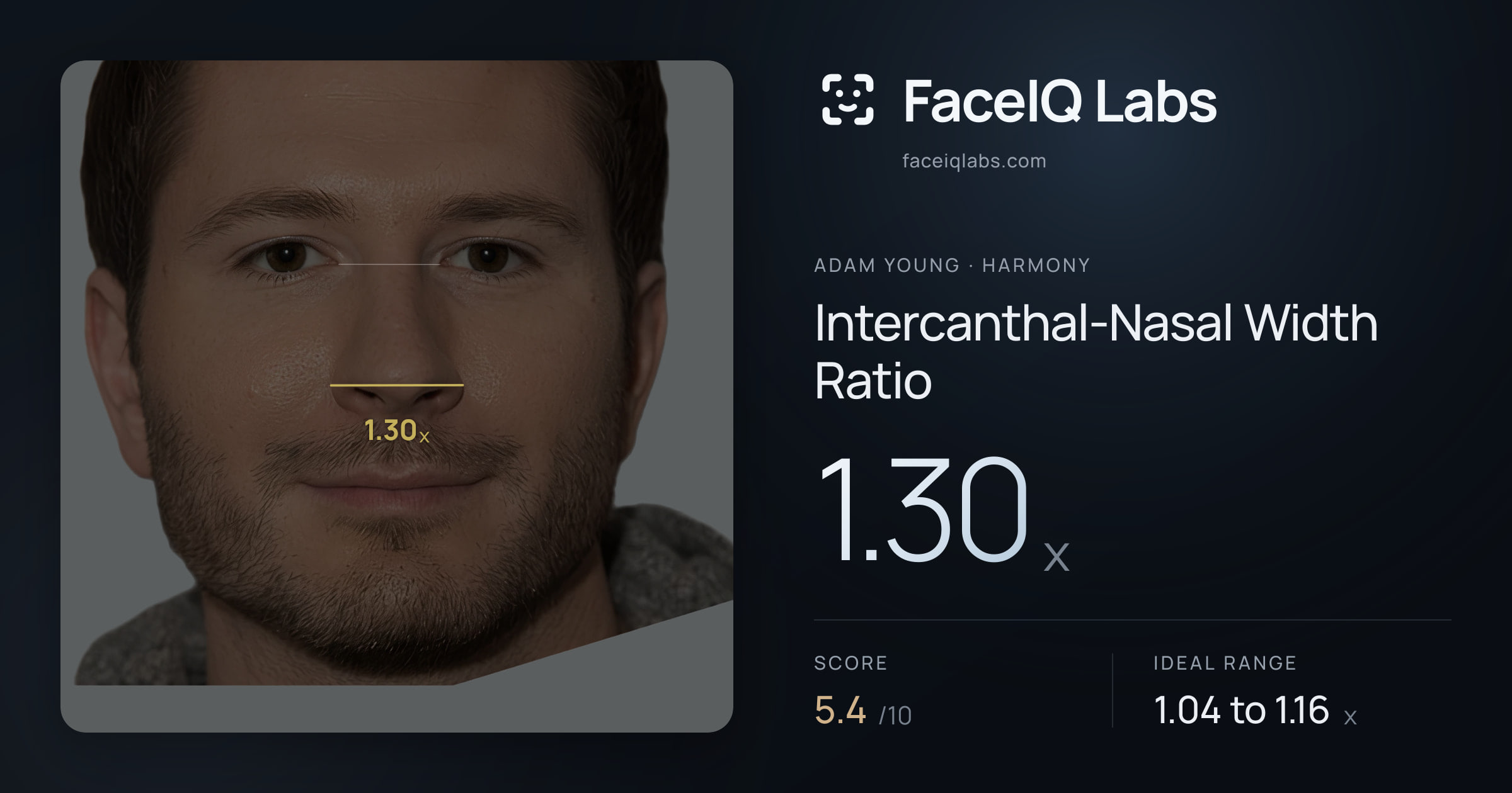 Adam Young Intercanthal-Nasal Width Ratio: 1.30x, drawn on the photo