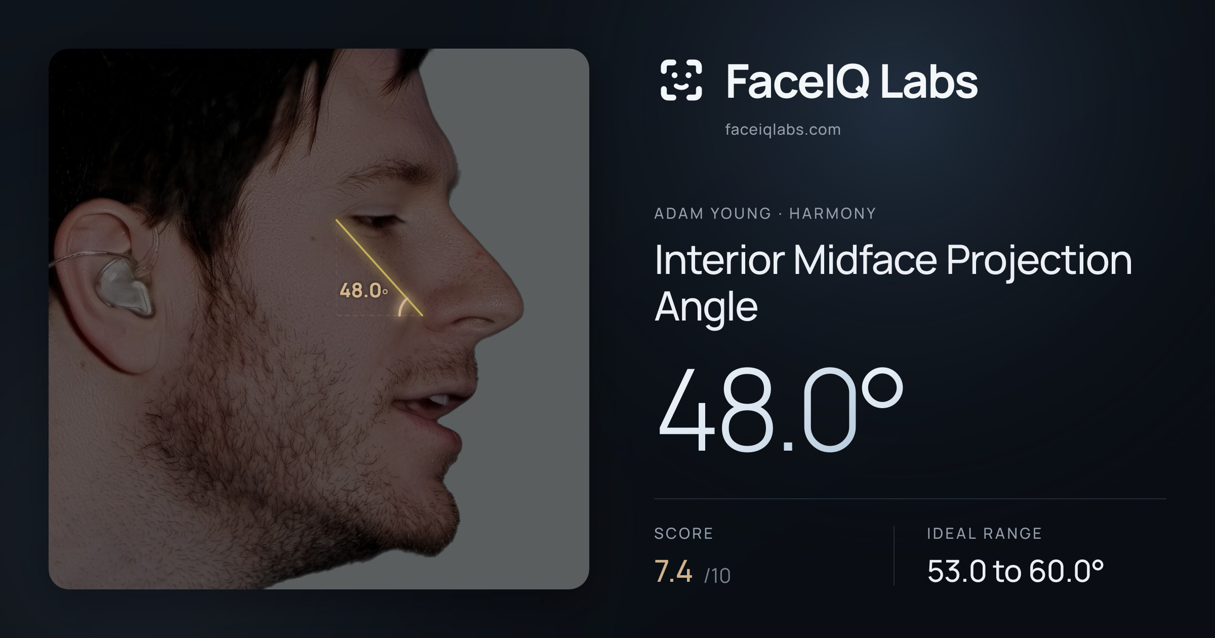 Adam Young Interior Midface Projection Angle: 48.0°, drawn on the photo